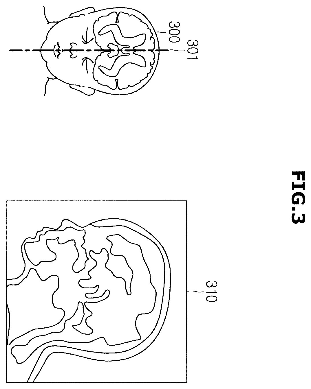 Patent US12508002 Figure 3 – Ultrasonic imaging apparatus and control method thereof