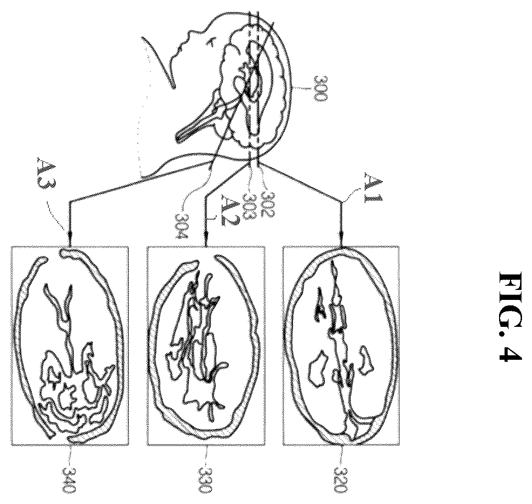 Patent US12508002 Figure 4 – Ultrasonic imaging apparatus and control method thereof