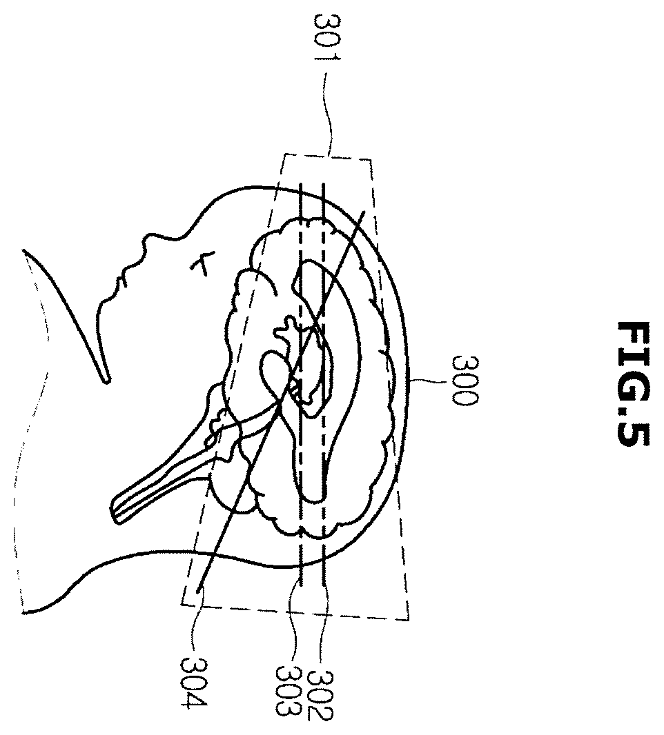Patent US12508002 Figure 5 – Ultrasonic imaging apparatus and control method thereof