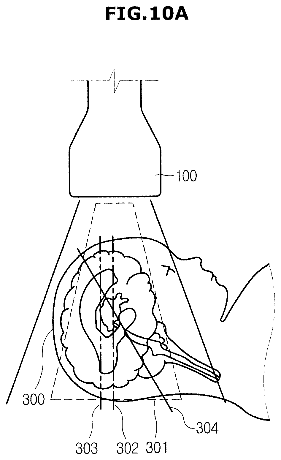 Patent US12508002 Figure 13 – Ultrasonic imaging apparatus and control method thereof
