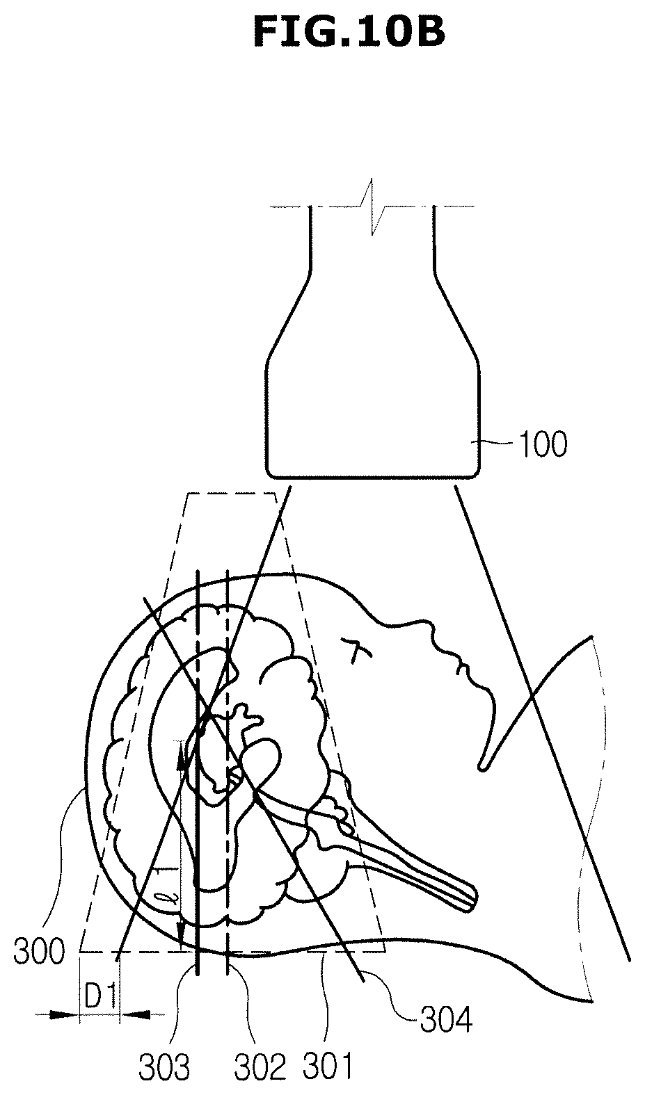 Patent US12508002 Figure 14 – Ultrasonic imaging apparatus and control method thereof
