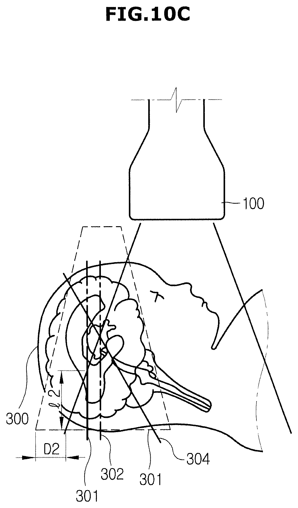 Patent US12508002 Figure 15 – Ultrasonic imaging apparatus and control method thereof