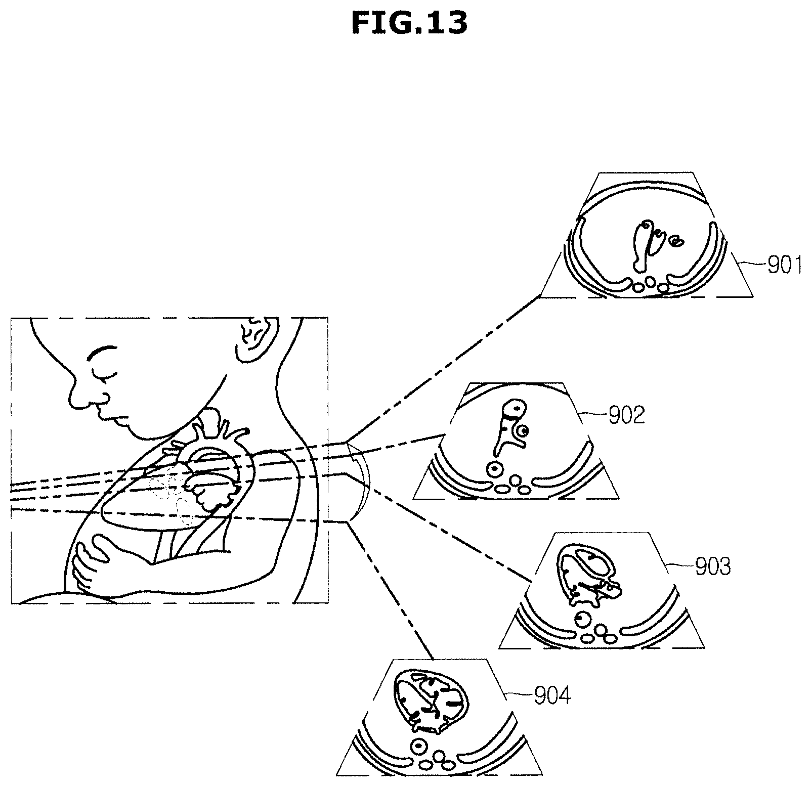 Patent US12508002 Figure 20 – Ultrasonic imaging apparatus and control method thereof