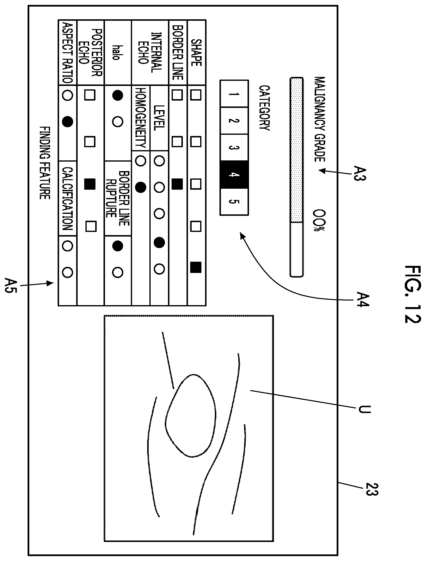 Patent US12508004 Figure 6 – Ultrasound diagnostic apparatus and control method of ultrasound diagnostic apparatus