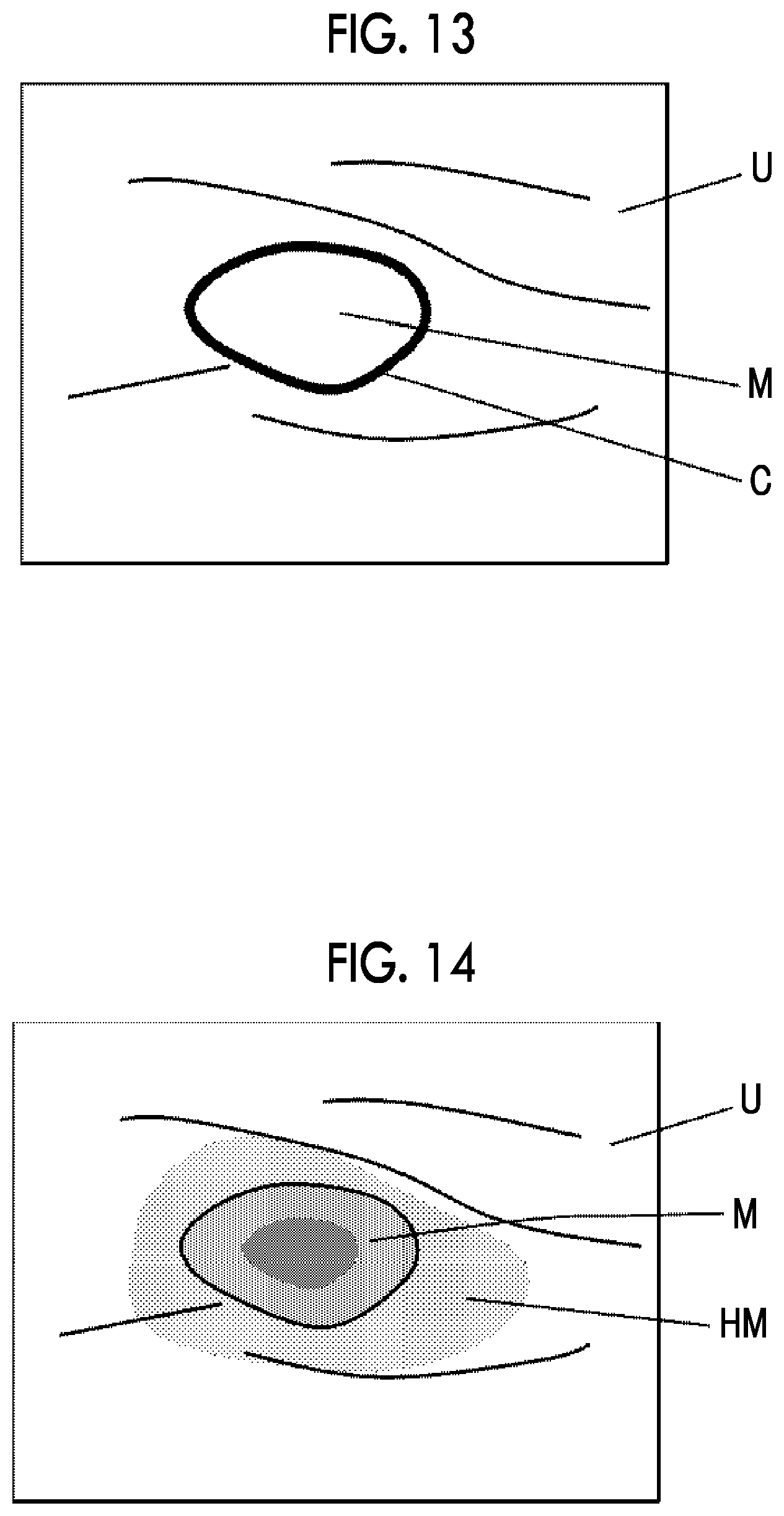 Patent US12508004 Figure 7 – Ultrasound diagnostic apparatus and control method of ultrasound diagnostic apparatus