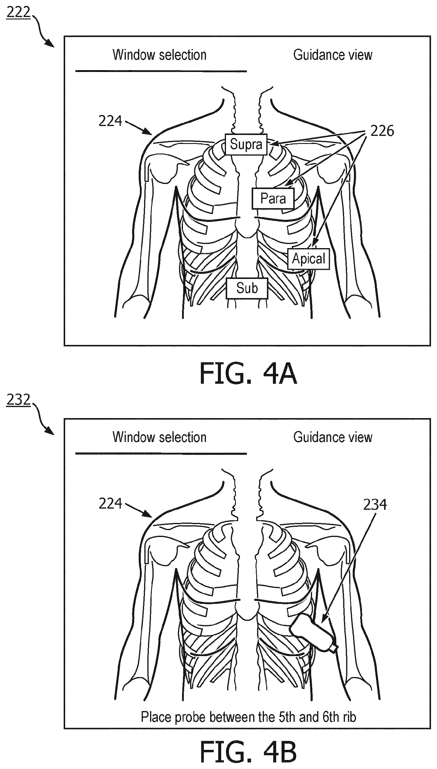 Patent US12508006 Figure 3 – Ultrasound imaging guidance and associated devices, systems, and methods