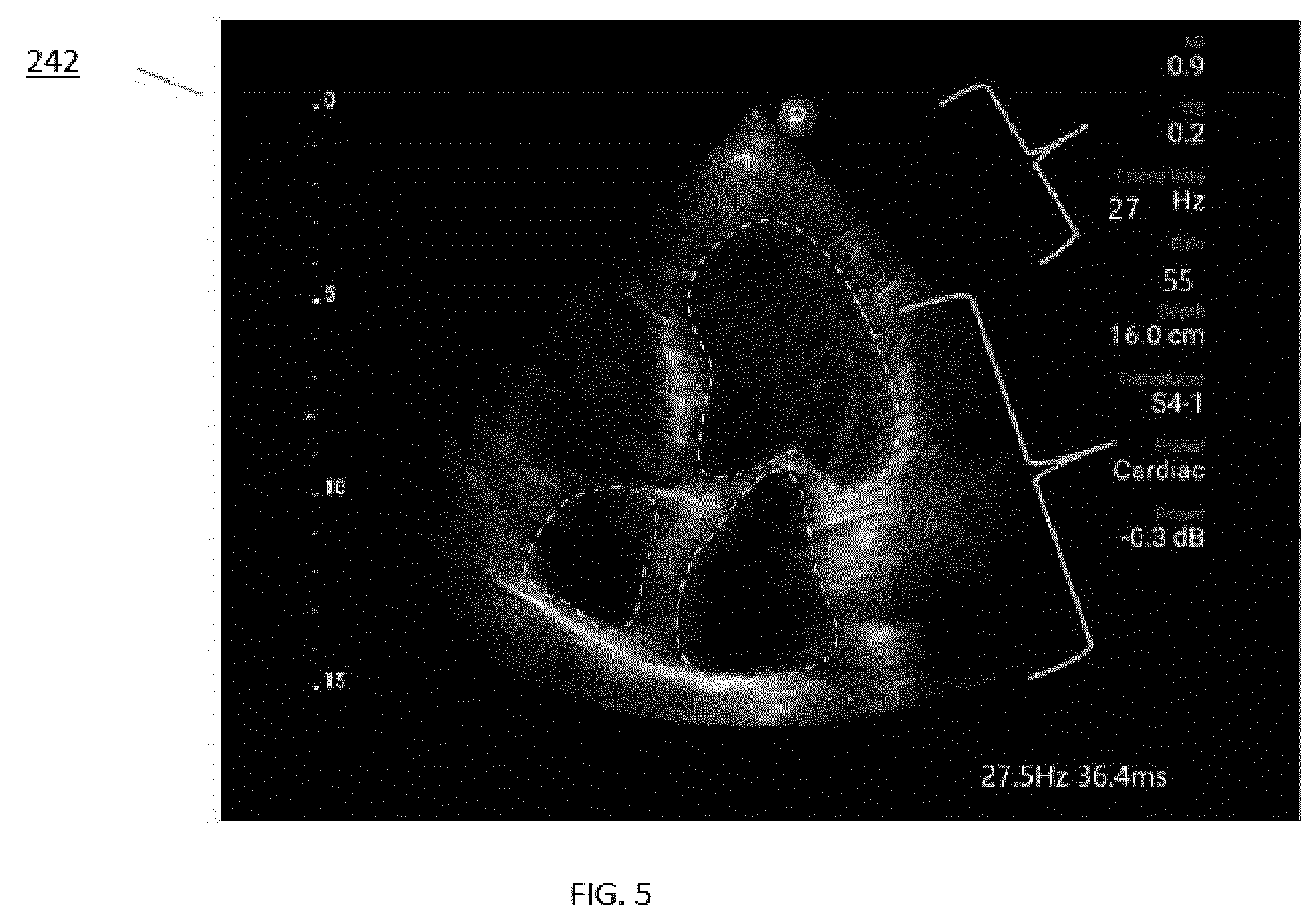Patent US12508006 Figure 4 – Ultrasound imaging guidance and associated devices, systems, and methods