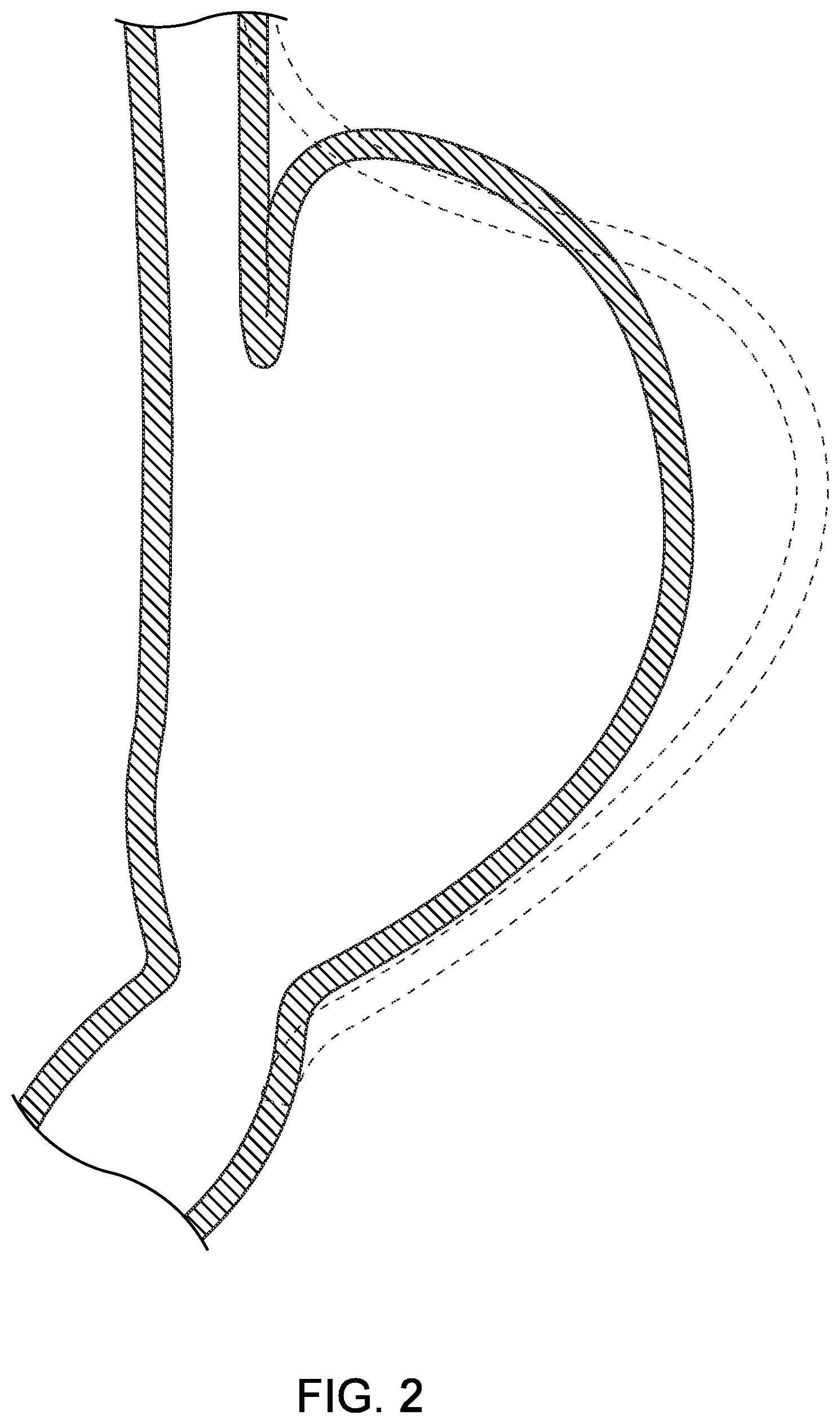 Patent US12508007 Figure 2 – Methods and devices for manipulating and fastening tissue