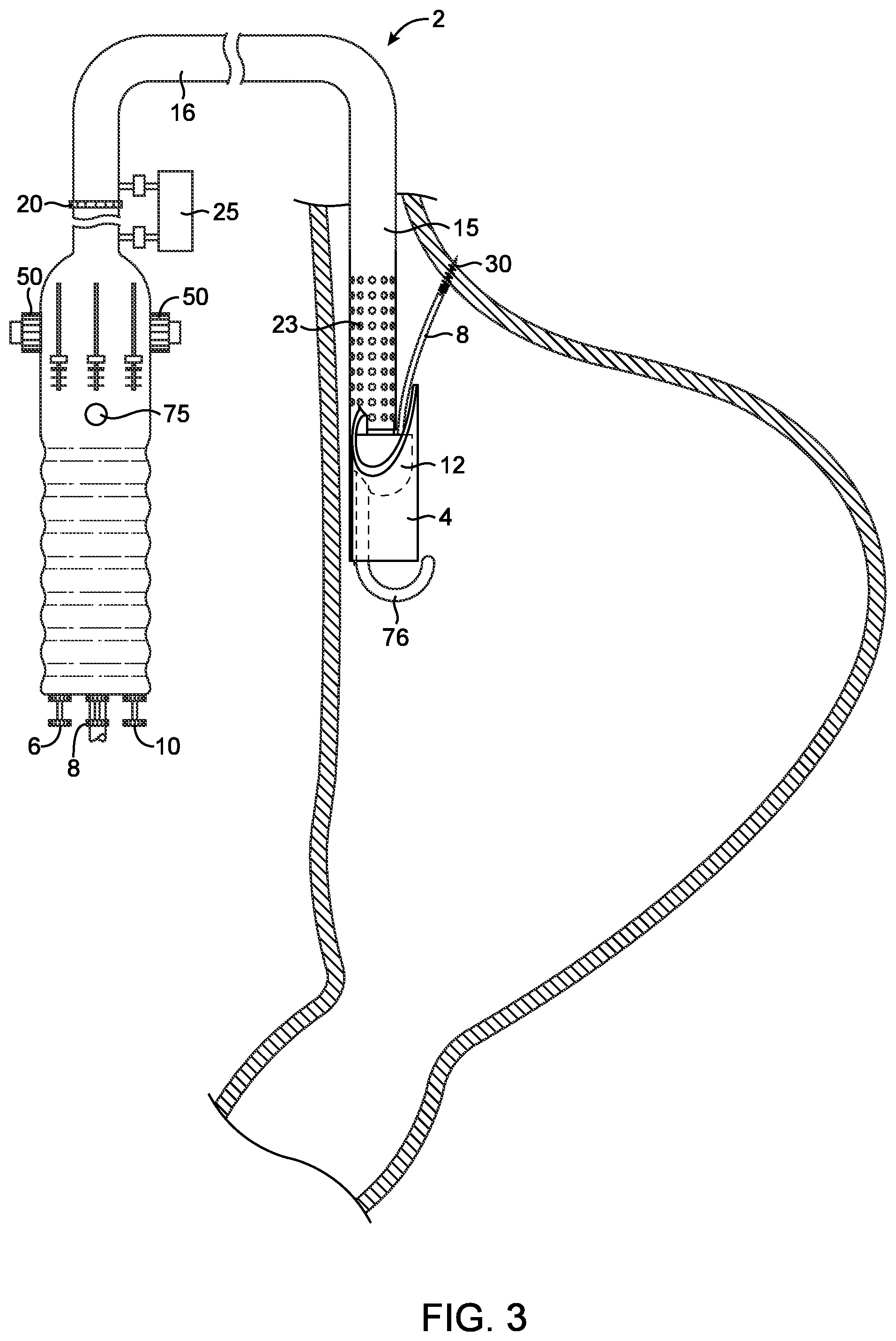Patent US12508007 Figure 3 – Methods and devices for manipulating and fastening tissue