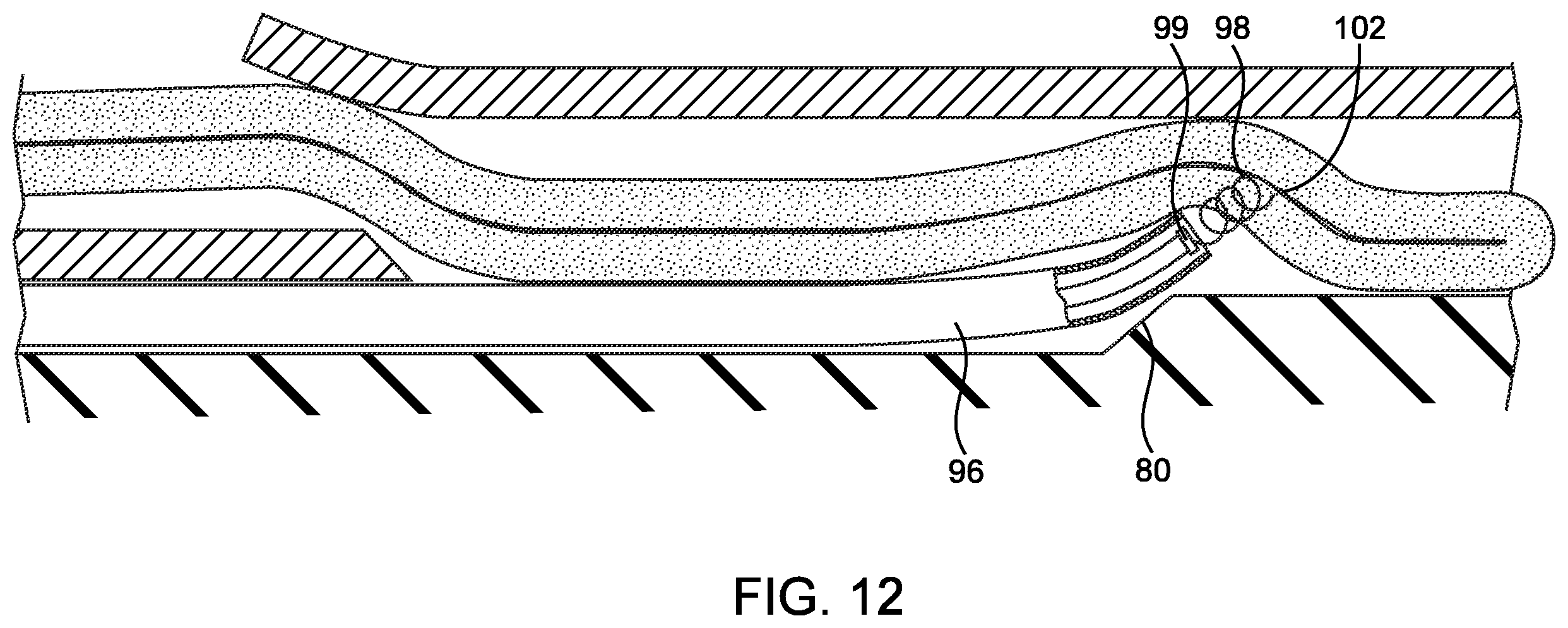 Patent US12508007 Figure 10 – Methods and devices for manipulating and fastening tissue