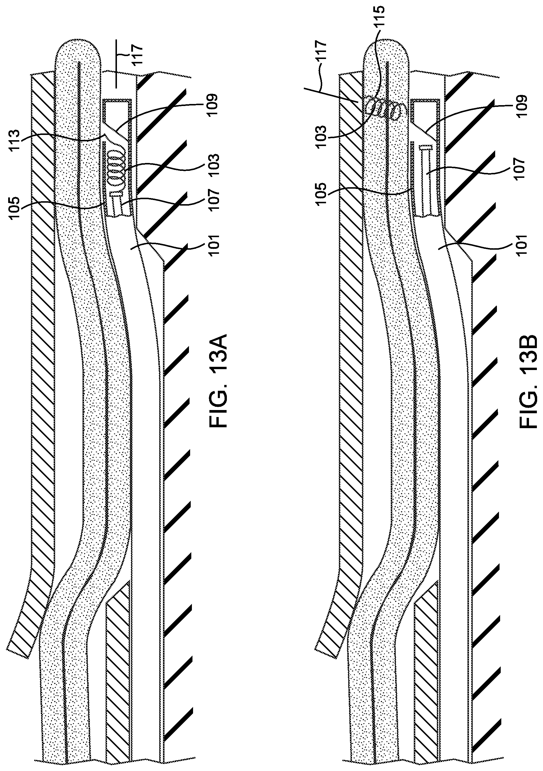 Patent US12508007 Figure 11 – Methods and devices for manipulating and fastening tissue