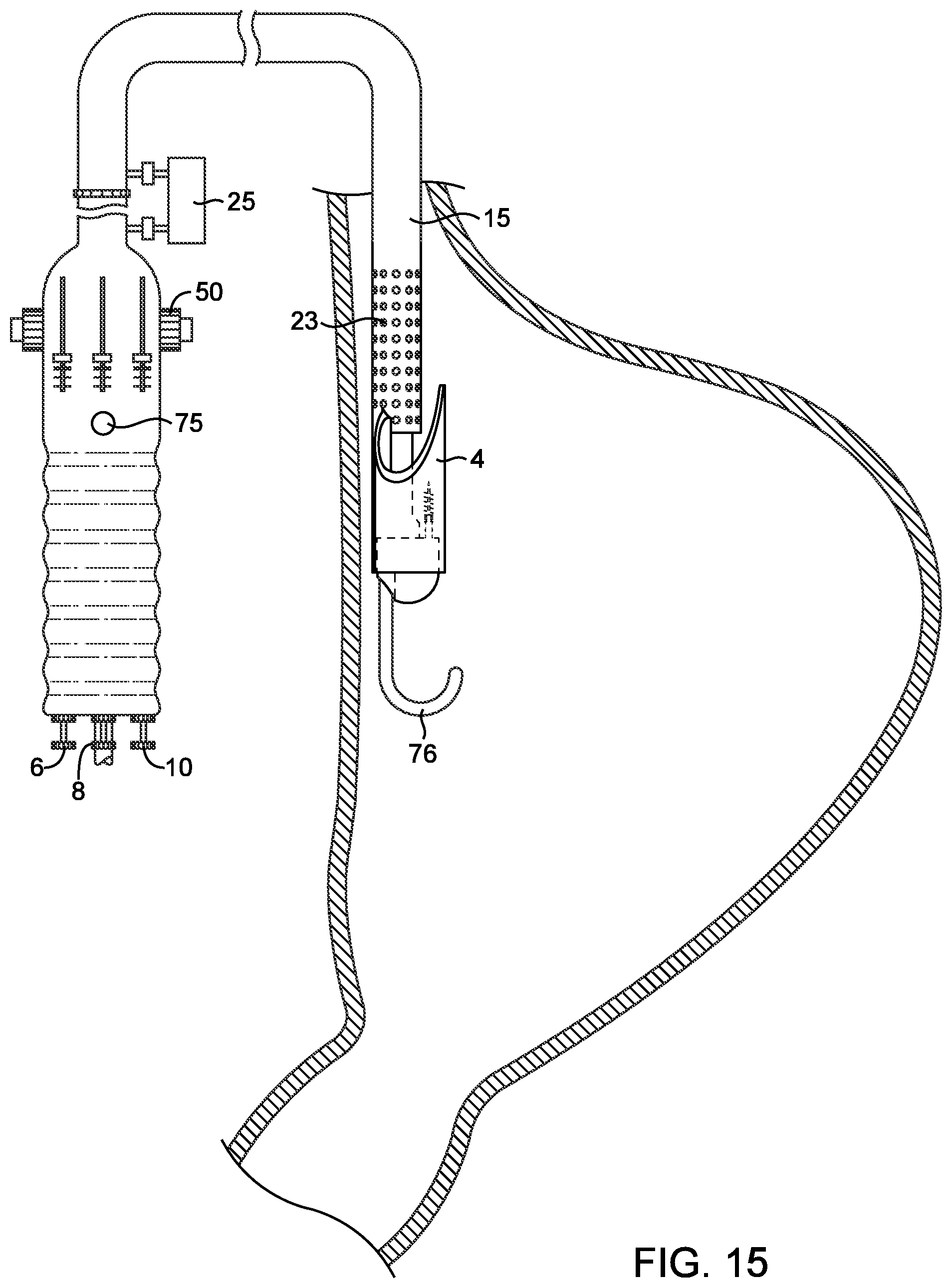 Patent US12508007 Figure 13 – Methods and devices for manipulating and fastening tissue