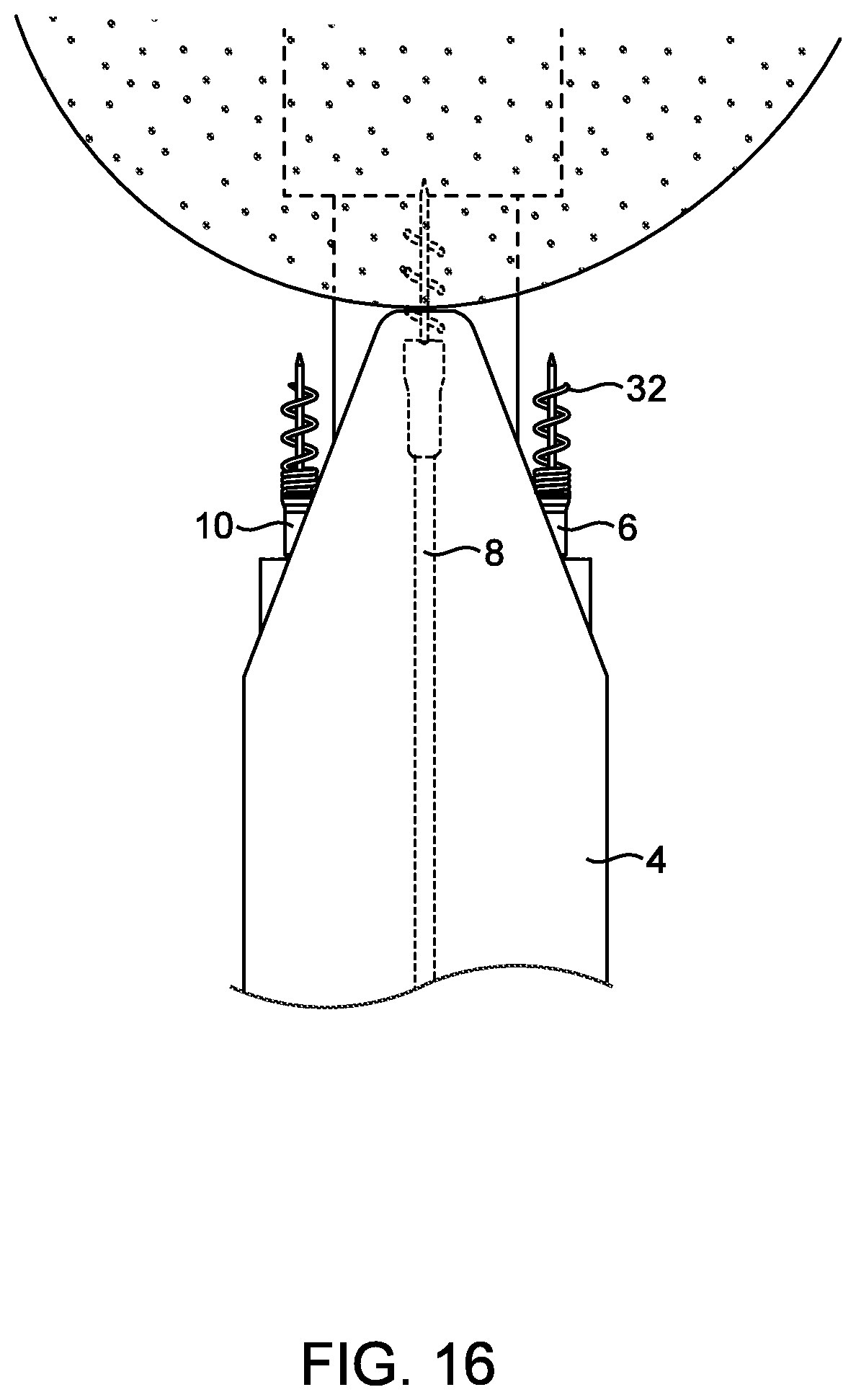 Patent US12508007 Figure 14 – Methods and devices for manipulating and fastening tissue