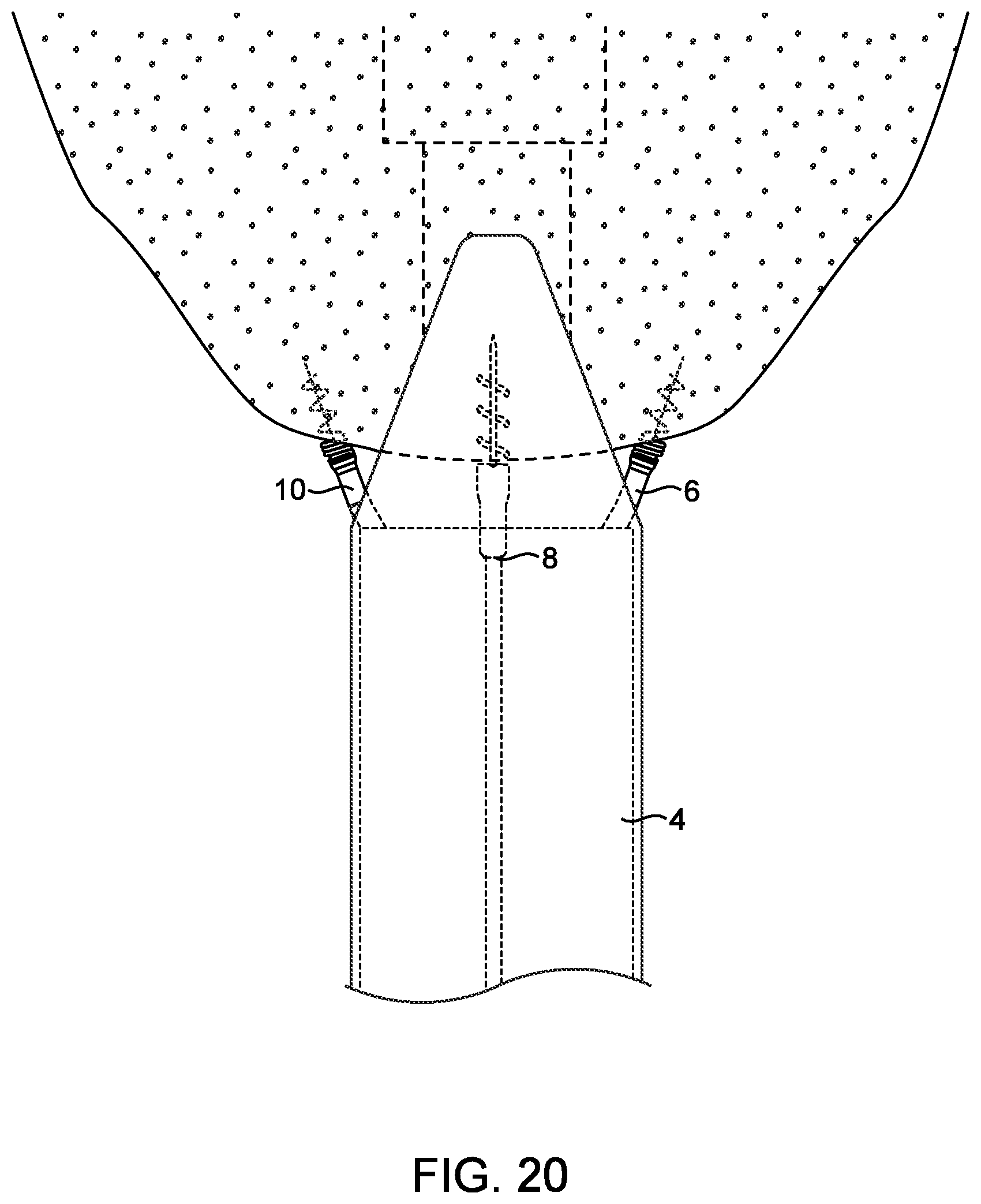 Patent US12508007 Figure 18 – Methods and devices for manipulating and fastening tissue