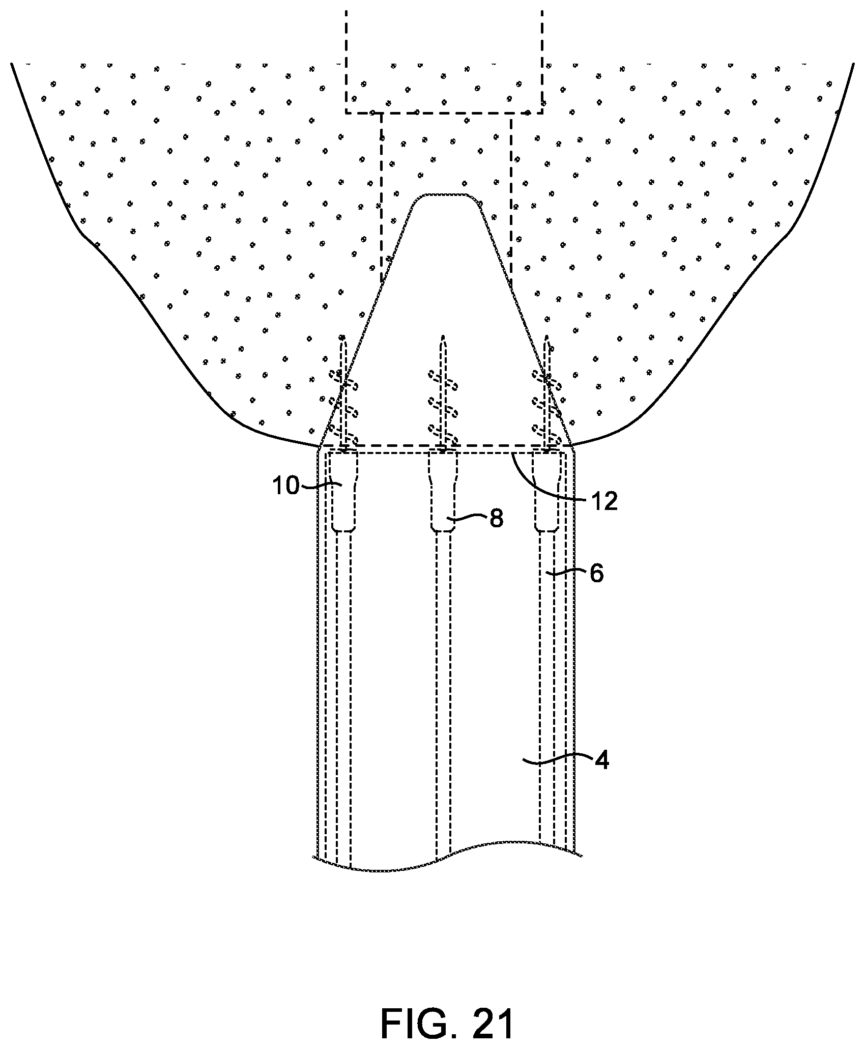 Patent US12508007 Figure 19 – Methods and devices for manipulating and fastening tissue