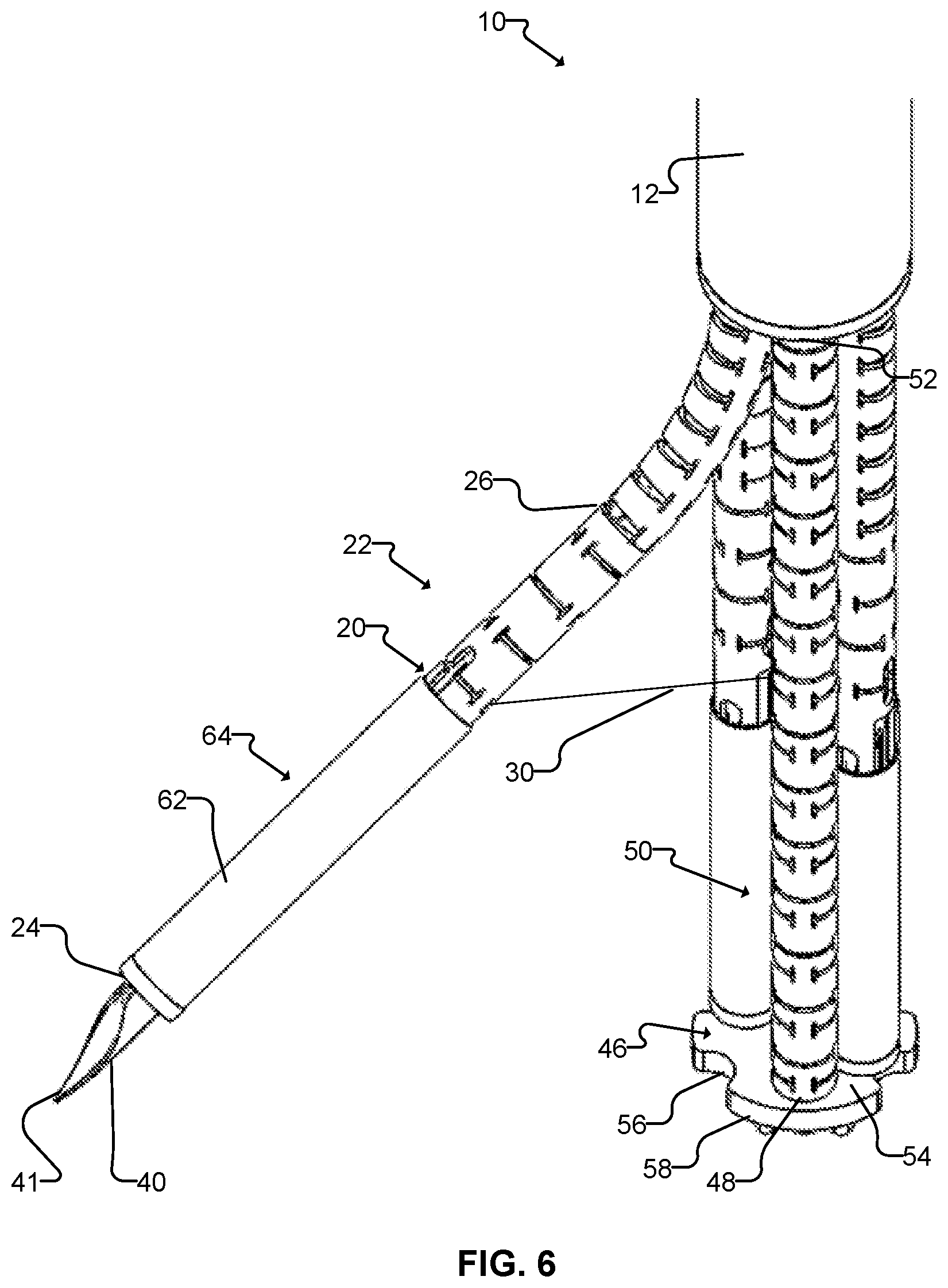 Patent US12508008 Figure 6 – Apparatus and methods for the delivery of biocompatible materials
