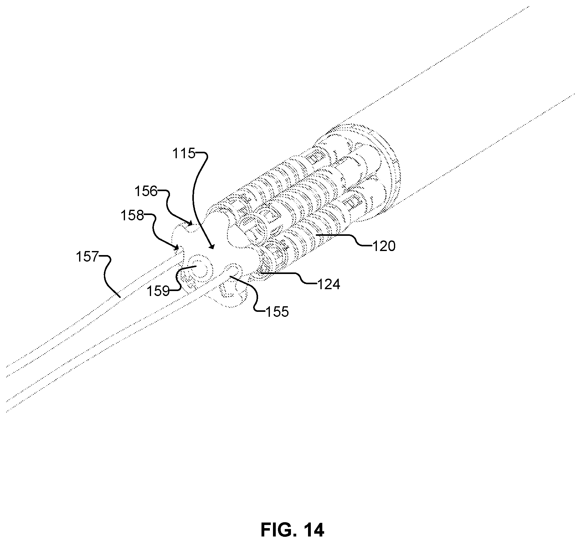 Patent US12508008 Figure 14 – Apparatus and methods for the delivery of biocompatible materials