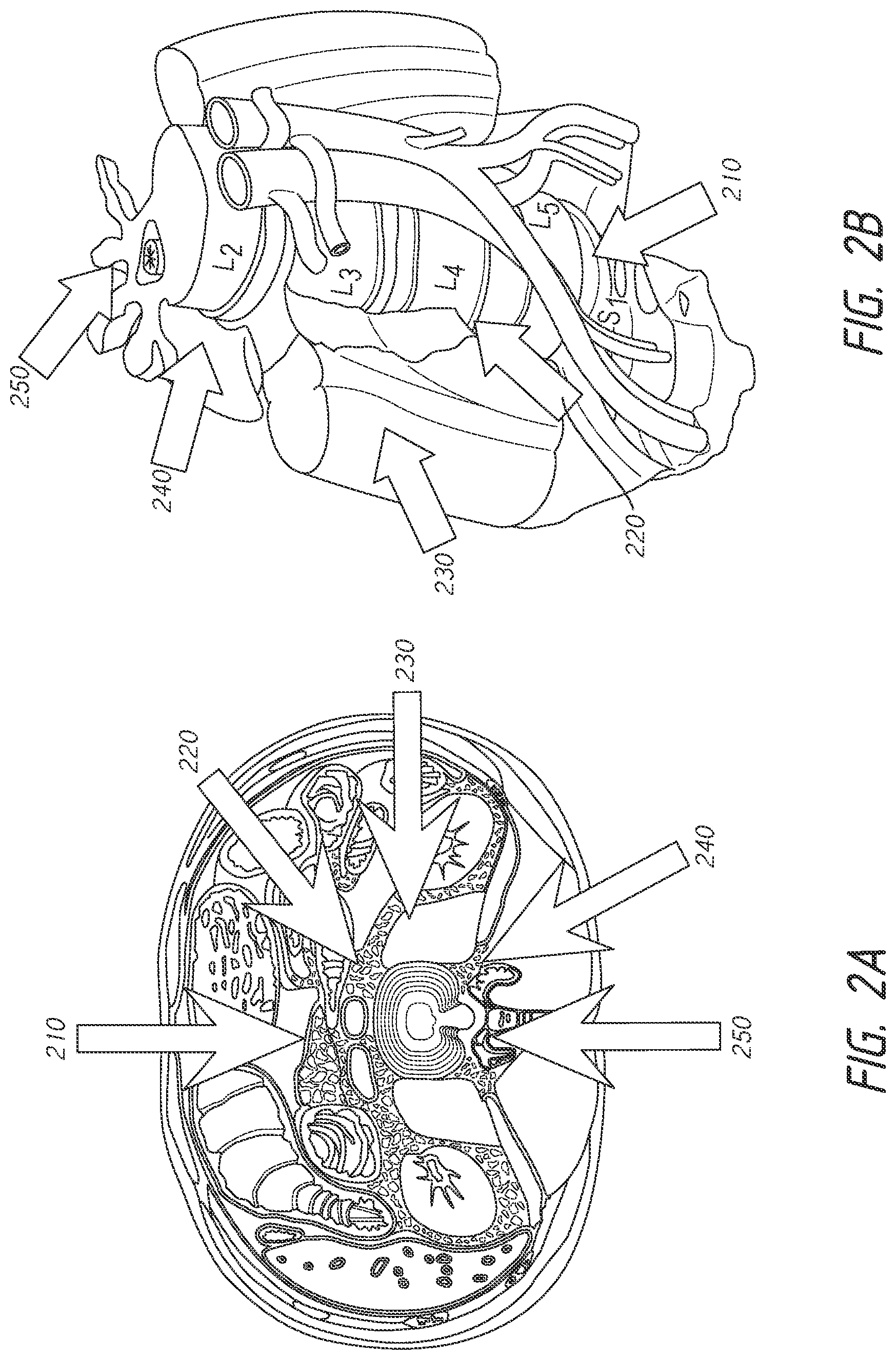 Patent US12508009 Figure 2 – Multi-portal split cannulas, endoscopic hemostatic dispensers and surgical tools