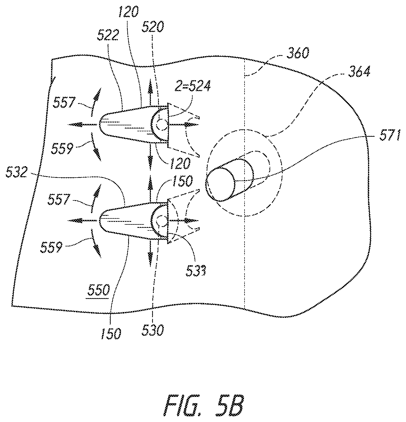 Patent US12508009 Figure 4 – Multi-portal split cannulas, endoscopic hemostatic dispensers and surgical tools