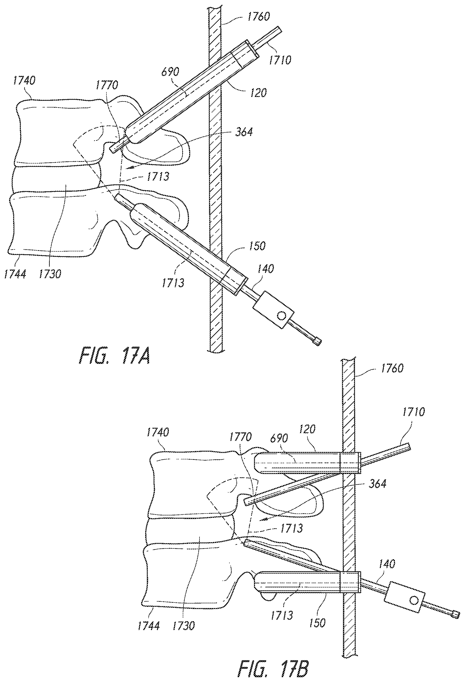 Patent US12508009 Figure 10 – Multi-portal split cannulas, endoscopic hemostatic dispensers and surgical tools