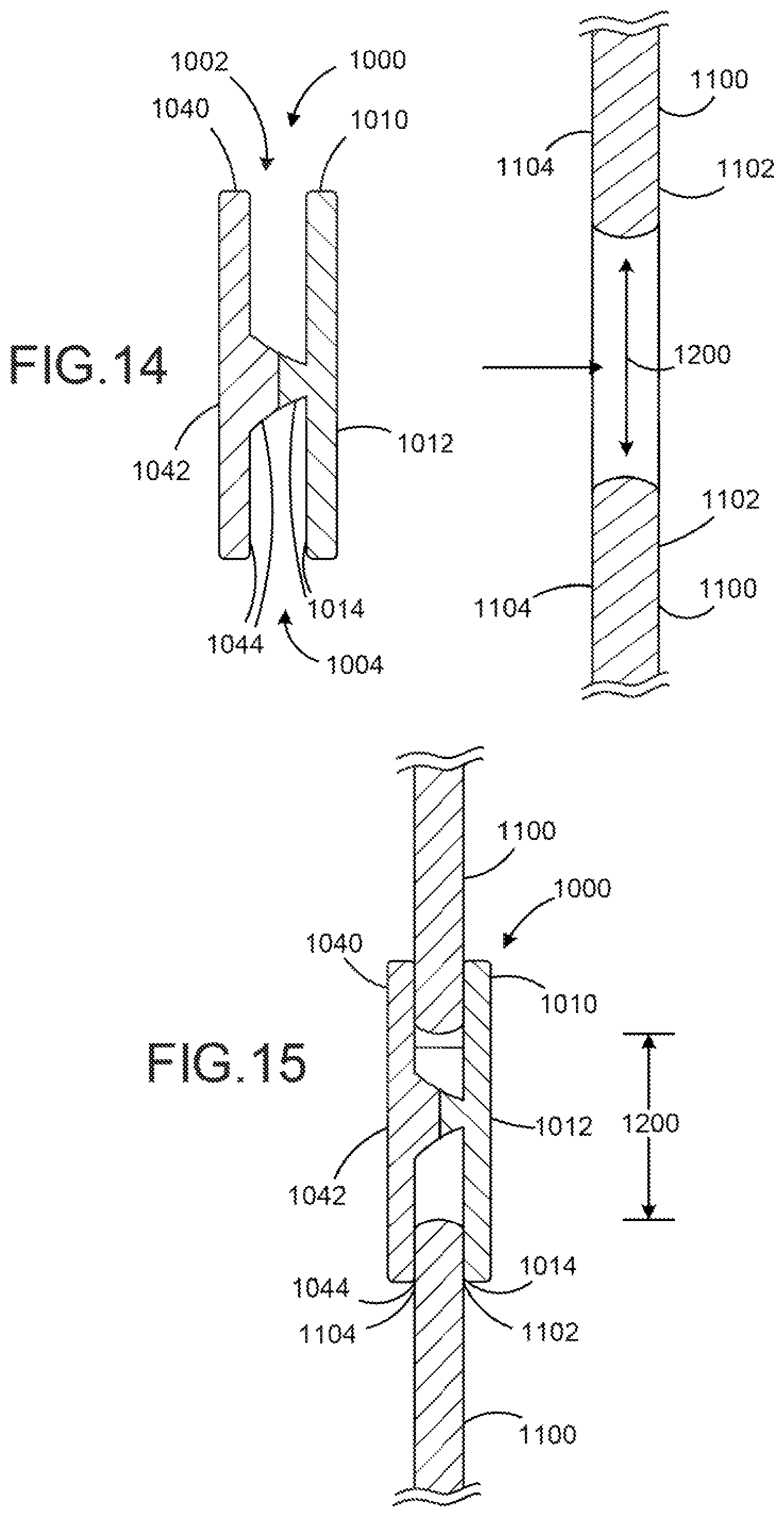 Patent US12508010 Figure 8 – Medical devices for repairing perforations in tissue, methods of manufacturing medical devices, and methods of implanting a medical device