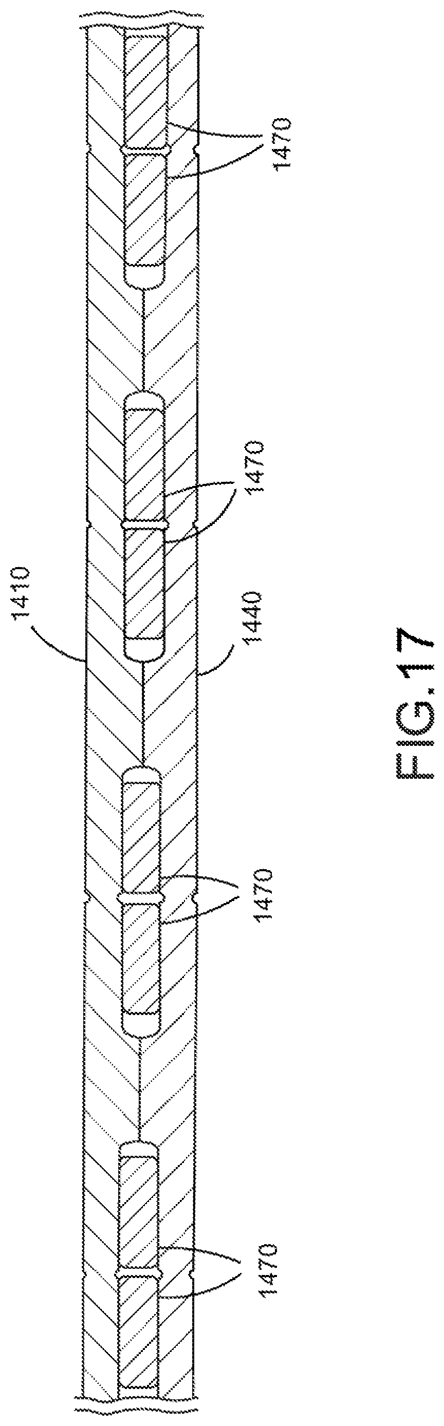 Patent US12508010 Figure 10 – Medical devices for repairing perforations in tissue, methods of manufacturing medical devices, and methods of implanting a medical device
