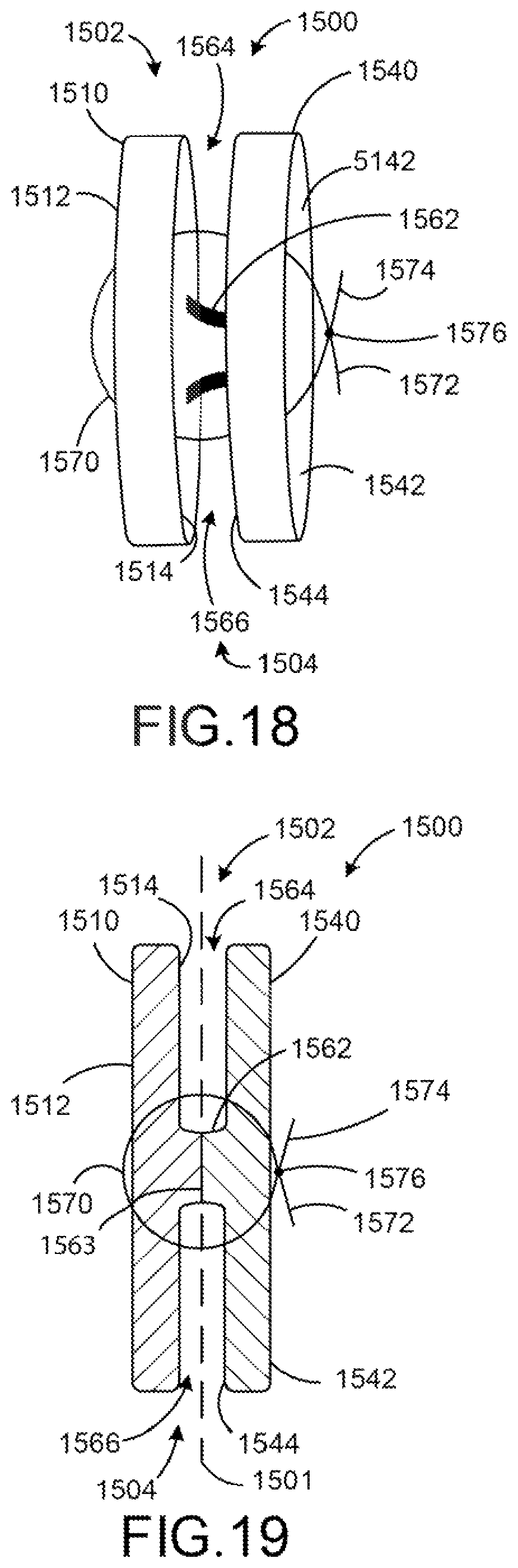 Patent US12508010 Figure 11 – Medical devices for repairing perforations in tissue, methods of manufacturing medical devices, and methods of implanting a medical device