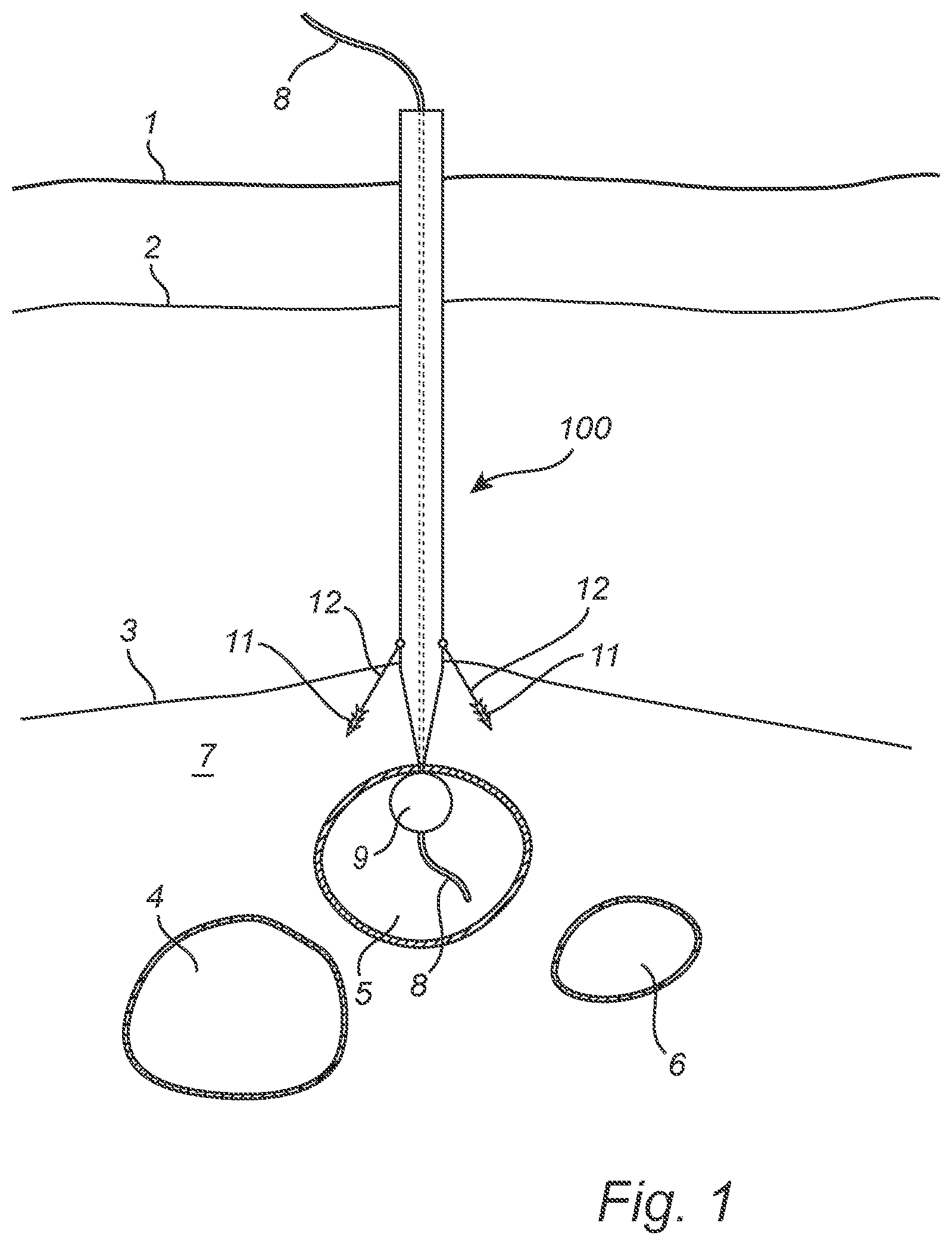 Patent US12508011 — Vascular closure device — Figure 1