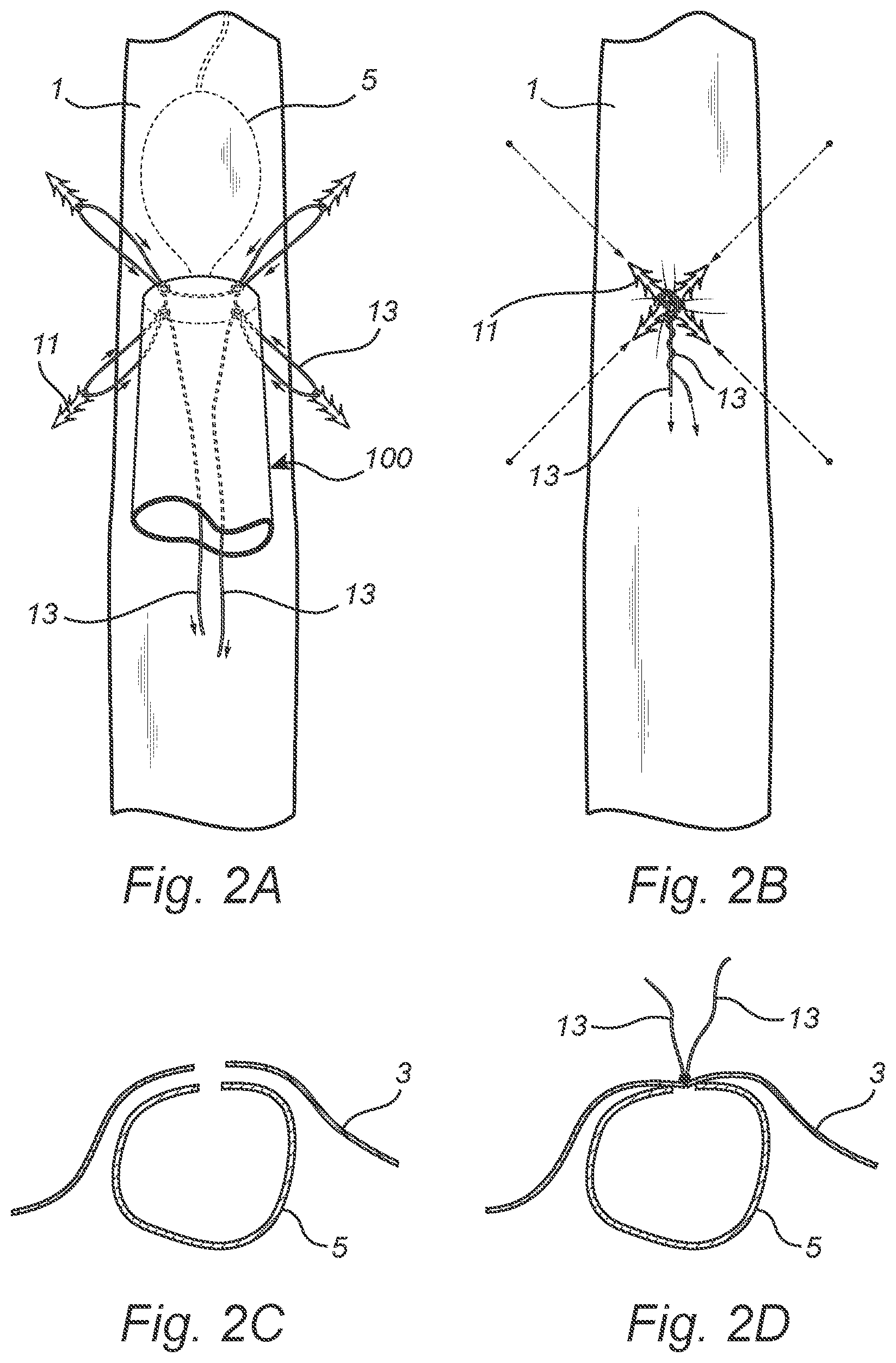 Patent US12508011 Figure 2 – Vascular closure device