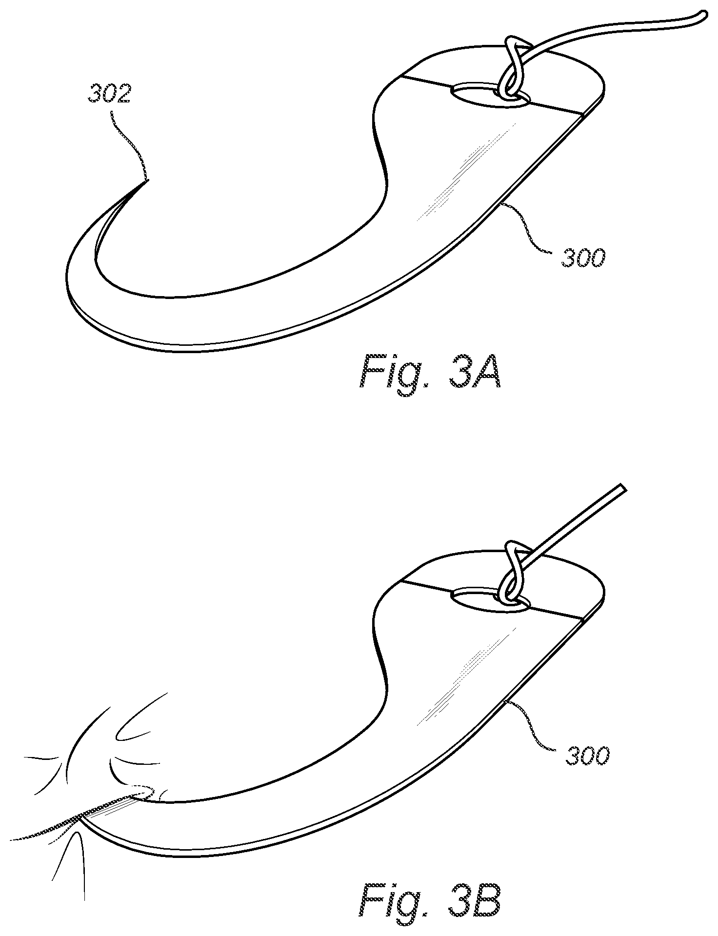 Patent US12508011 Figure 3 – Vascular closure device