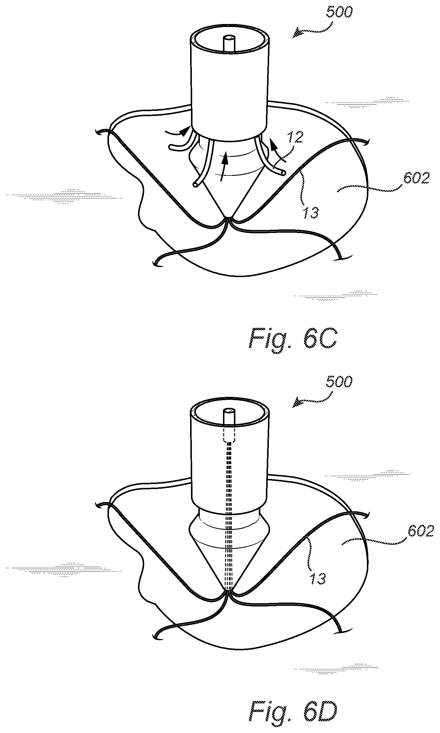 Patent US12508011 Figure 12 – Vascular closure device