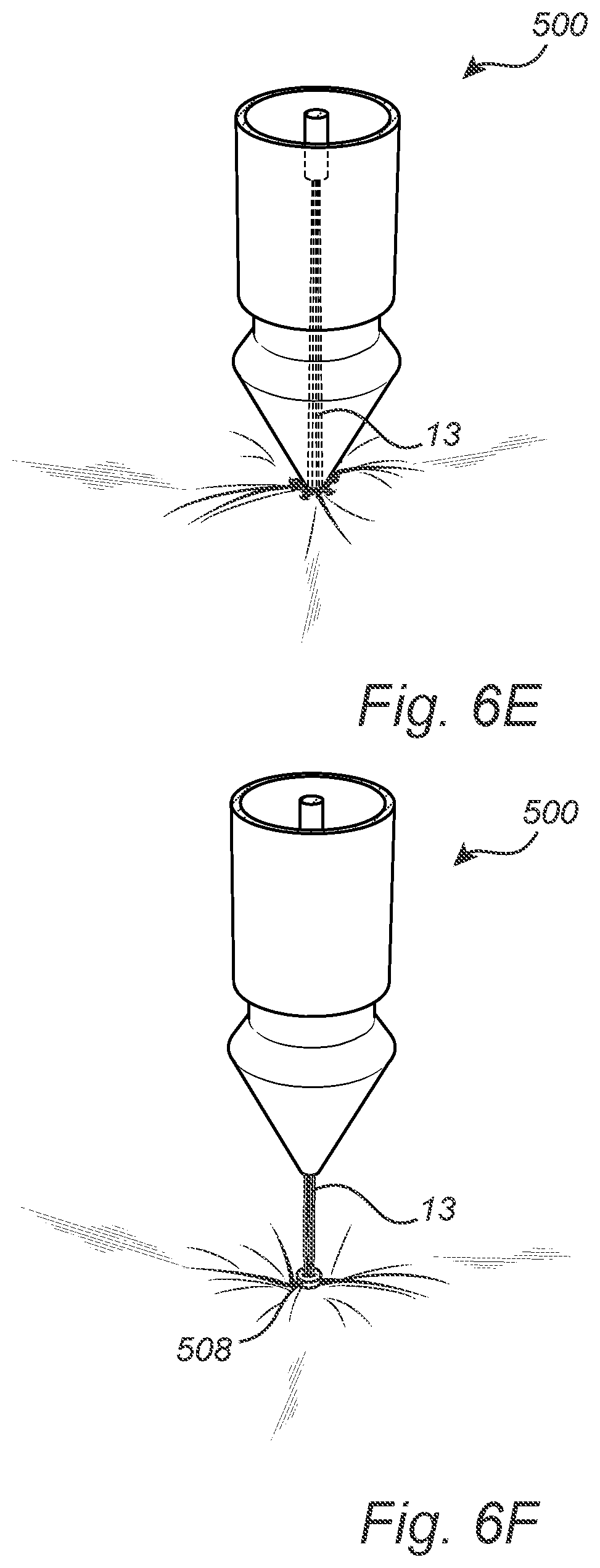 Patent US12508011 Figure 13 – Vascular closure device