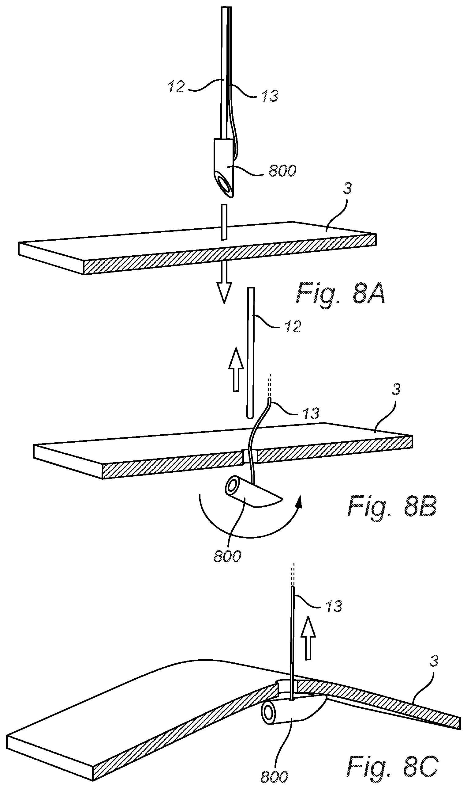 Patent US12508011 Figure 15 – Vascular closure device