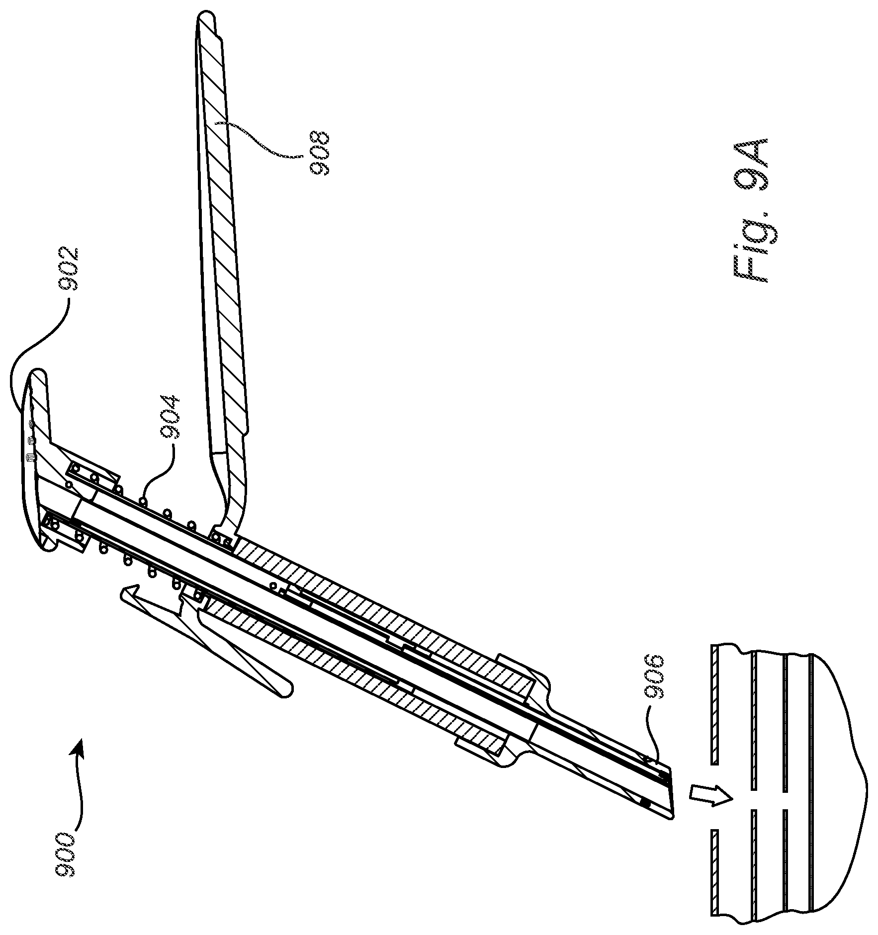 Patent US12508011 Figure 16 – Vascular closure device