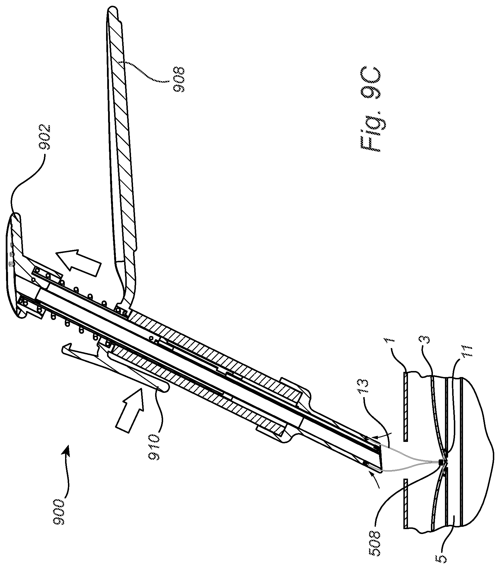 Patent US12508011 Figure 18 – Vascular closure device