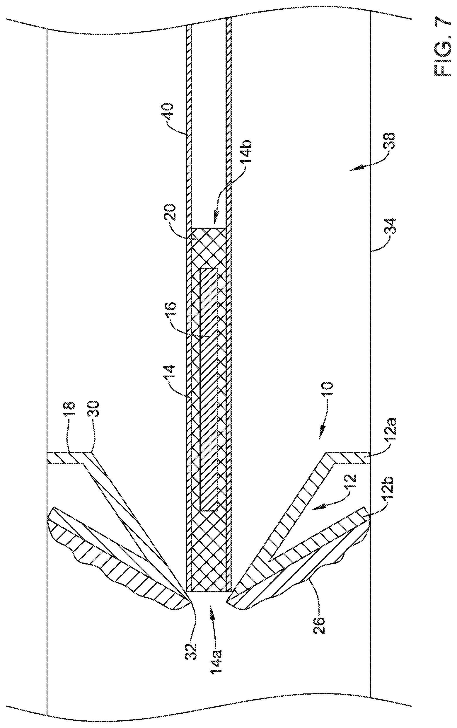 Patent US12508012 Figure 7 – Retrievable access valve