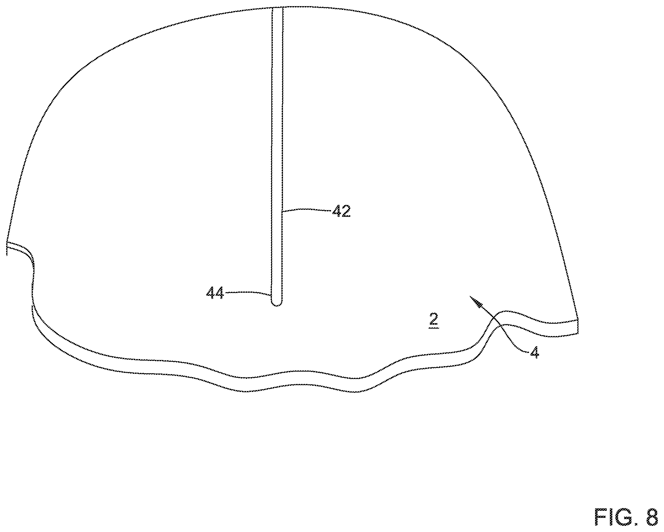 Patent US12508012 Figure 8 – Retrievable access valve