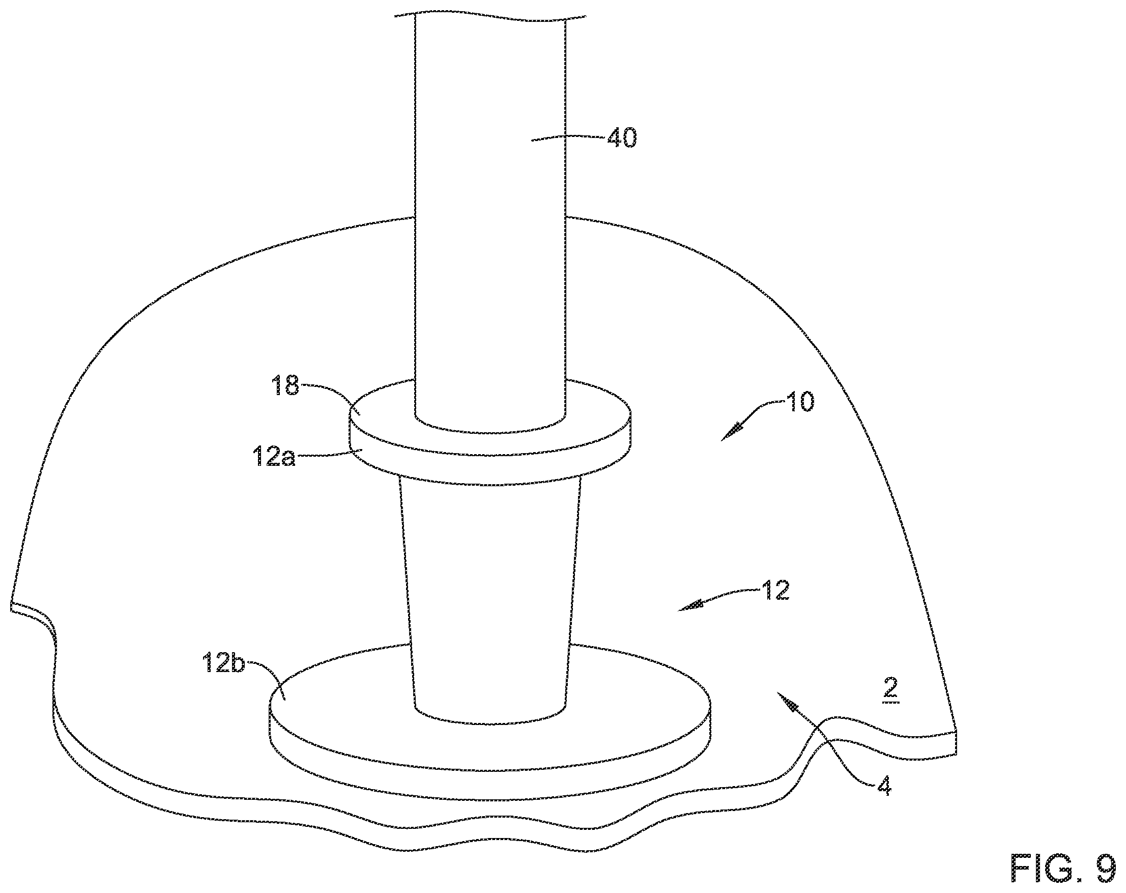 Patent US12508012 Figure 9 – Retrievable access valve