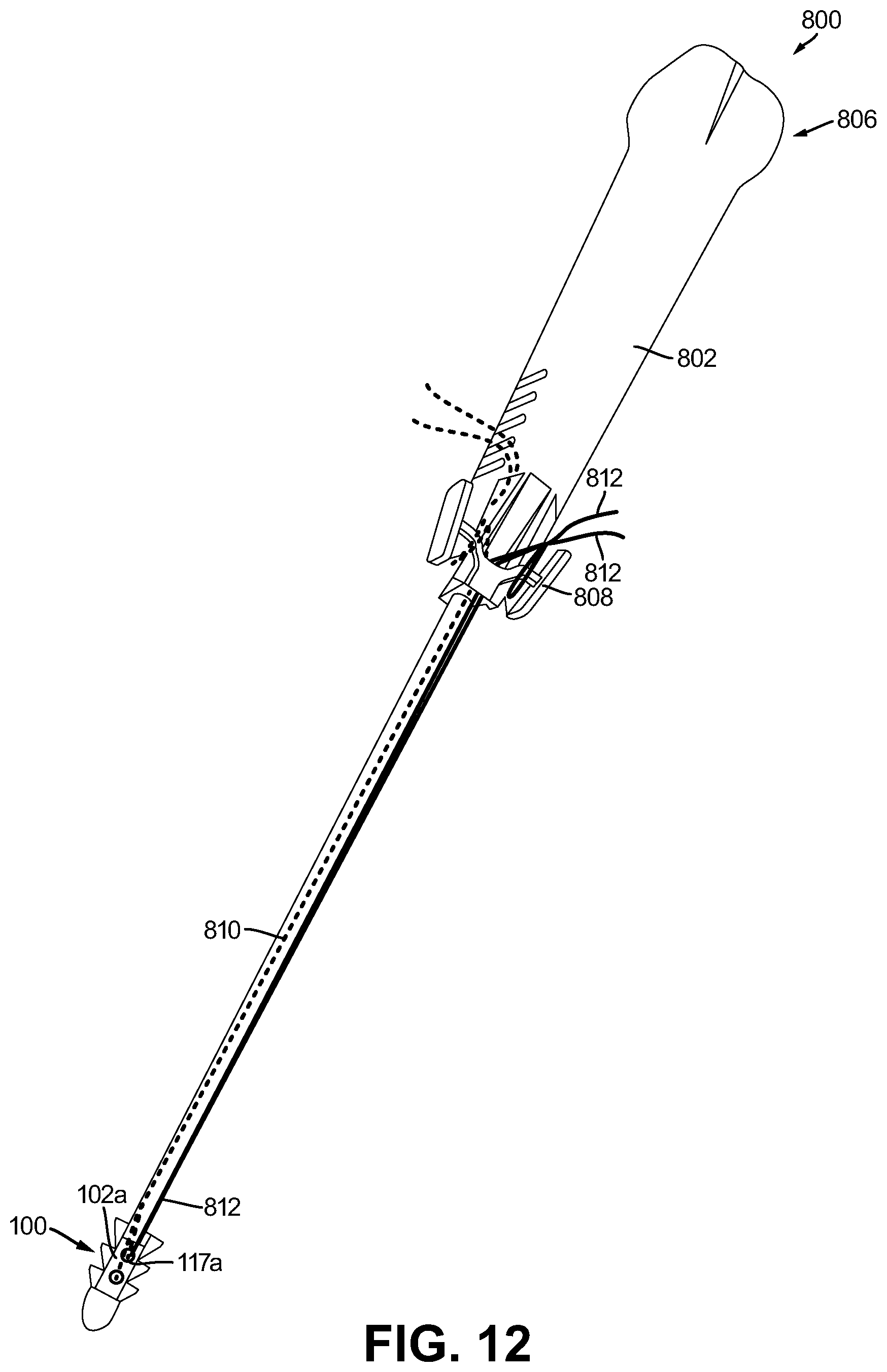 Patent US12508014 Figure 7 – Anchors and anchoring systems