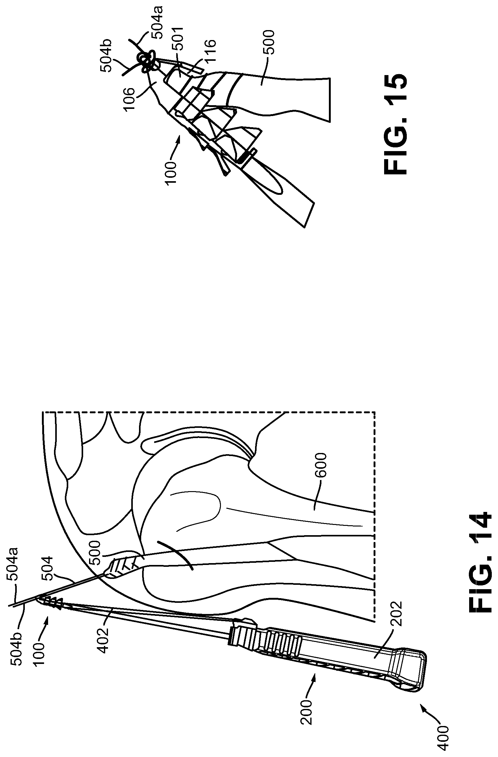 Patent US12508014 Figure 9 – Anchors and anchoring systems