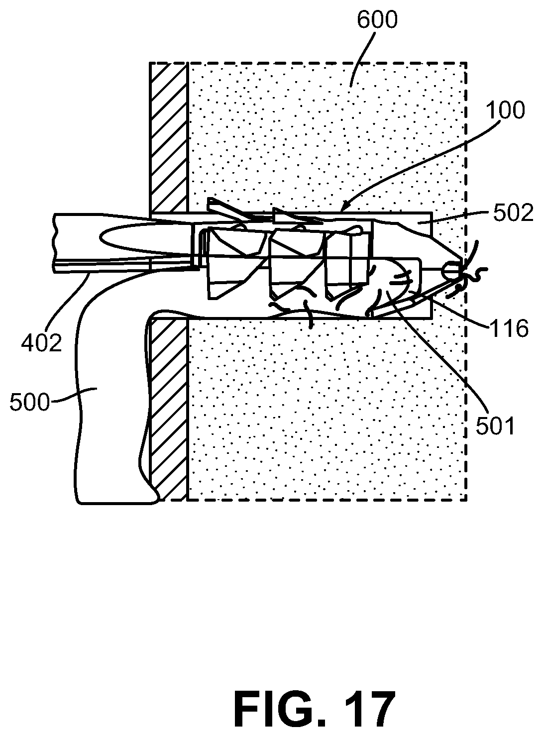 Patent US12508014 Figure 11 – Anchors and anchoring systems