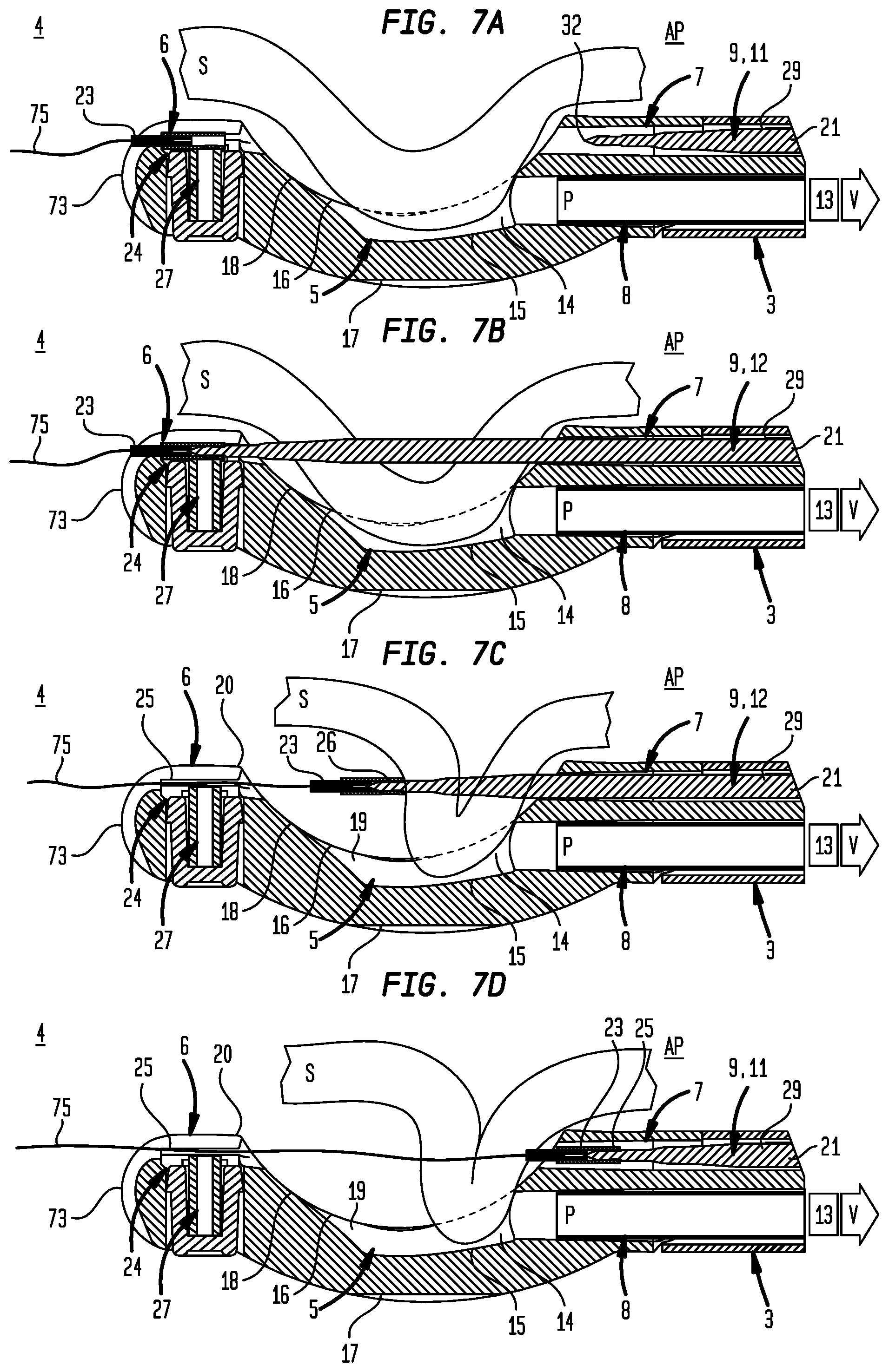 Patent US12508015 Figure 9 – Suturing apparatus needle drive