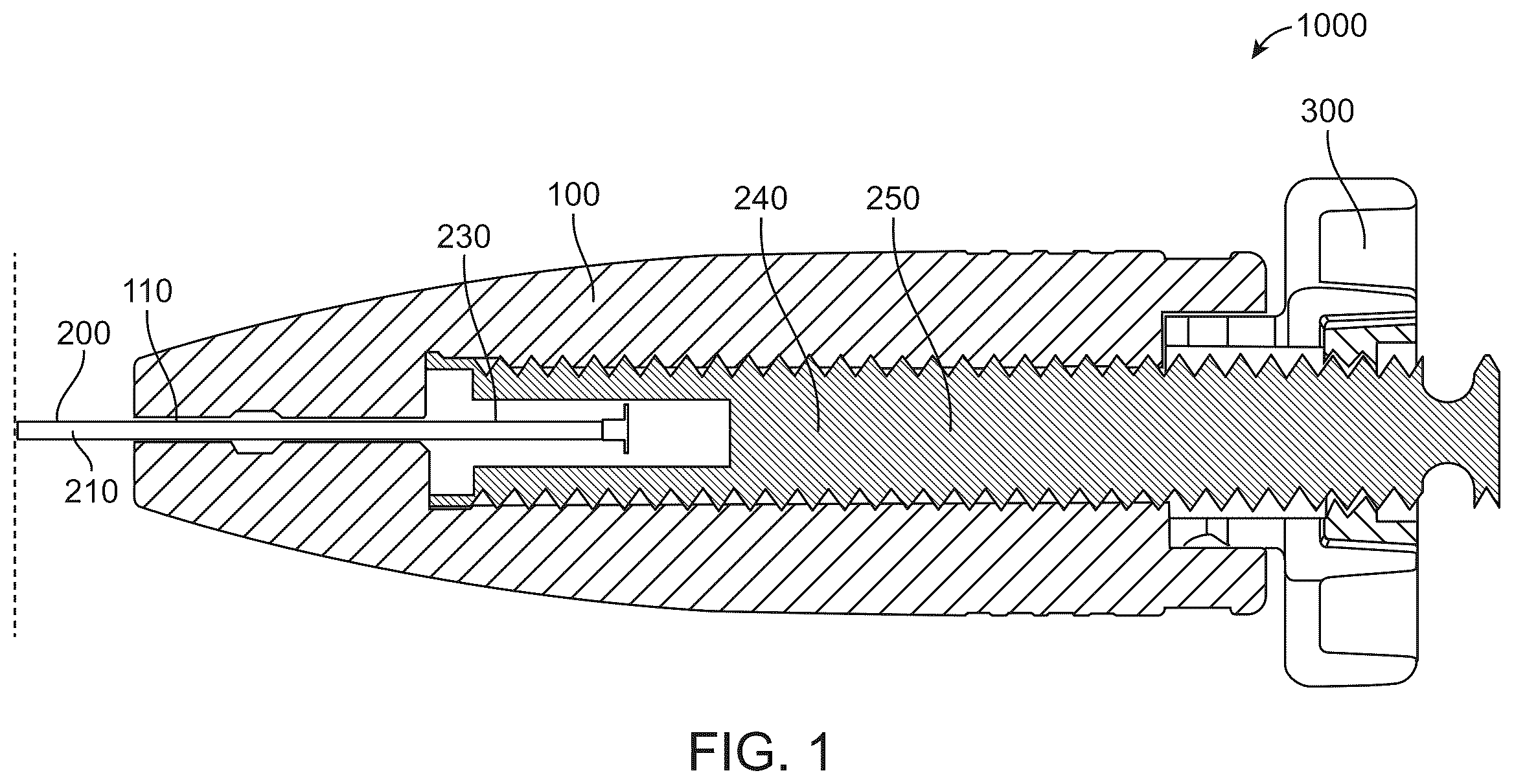 Patent US12508016 Figure 1 – All-suture anchor