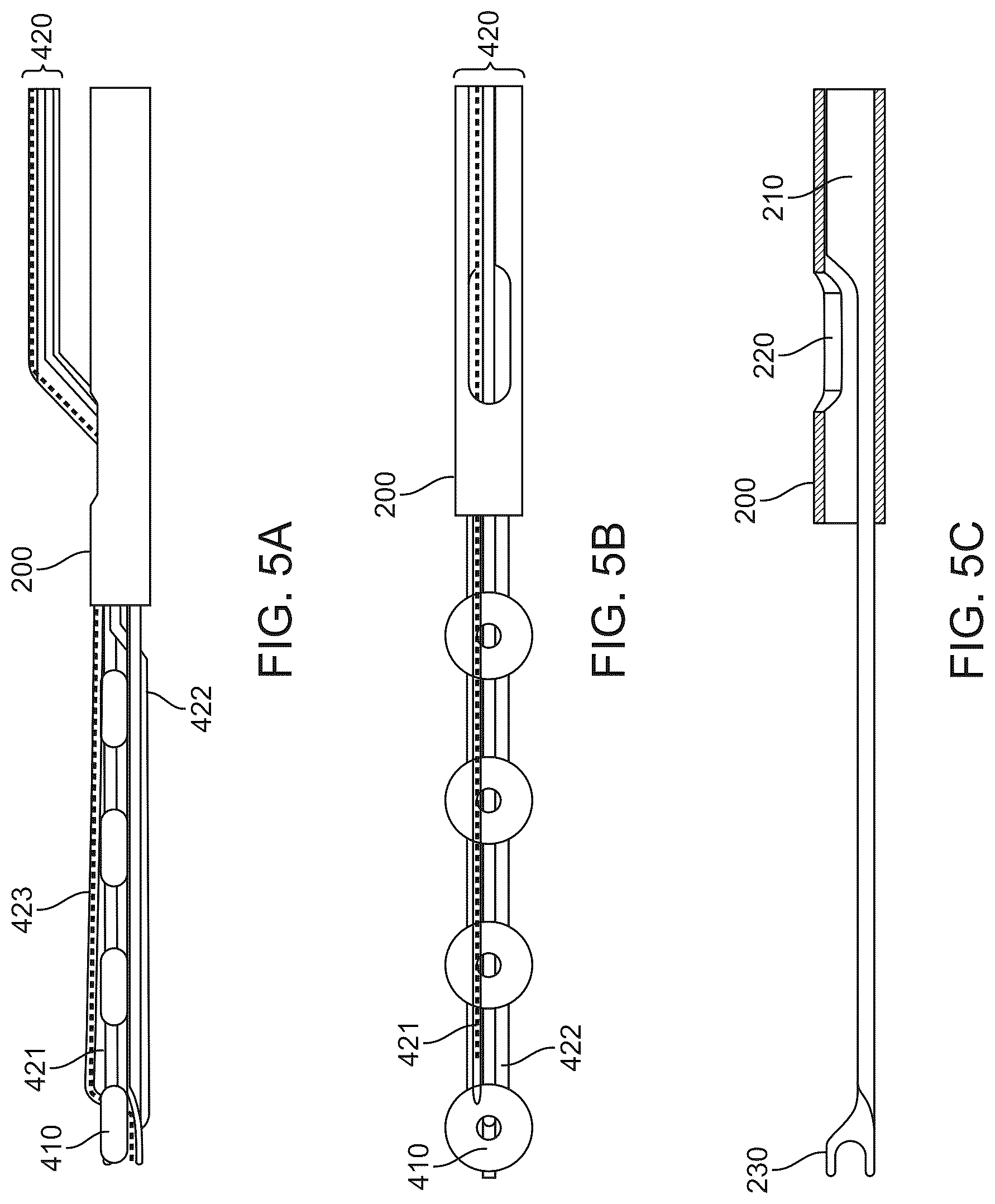 Patent US12508016 Figure 5 – All-suture anchor