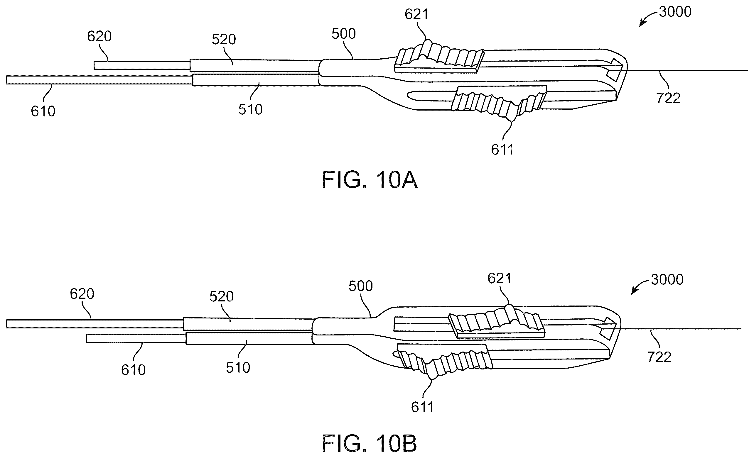 Patent US12508016 Figure 11 – All-suture anchor