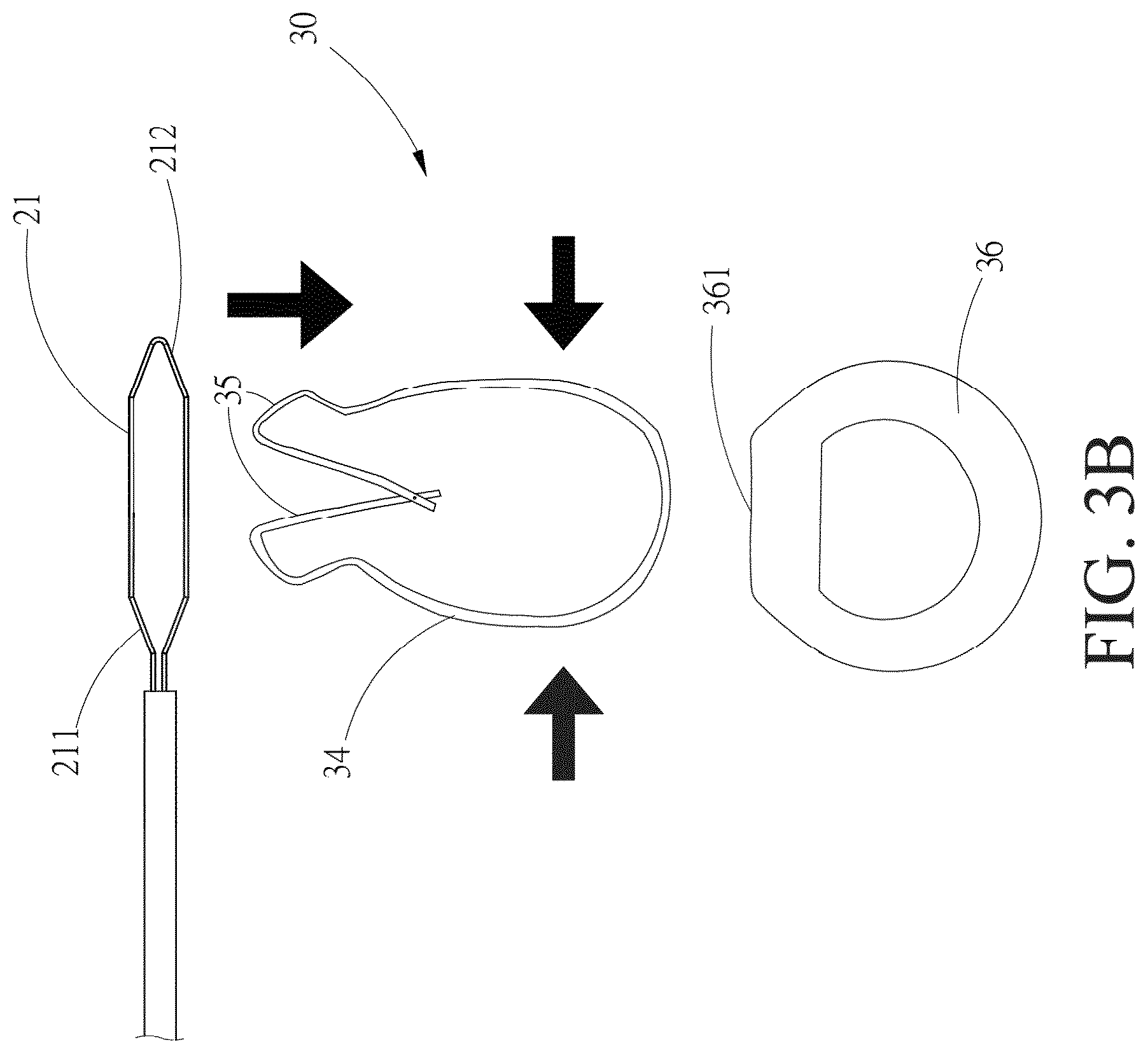 Patent US12508017 Figure 5 – Surgical guidewire device and suture fixation system