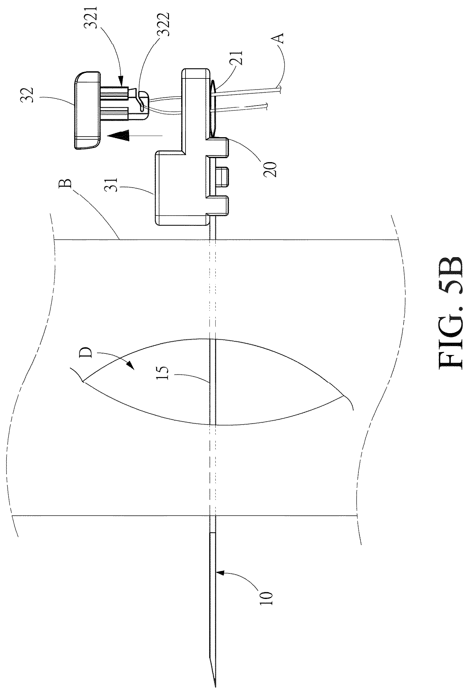 Patent US12508017 Figure 10 – Surgical guidewire device and suture fixation system