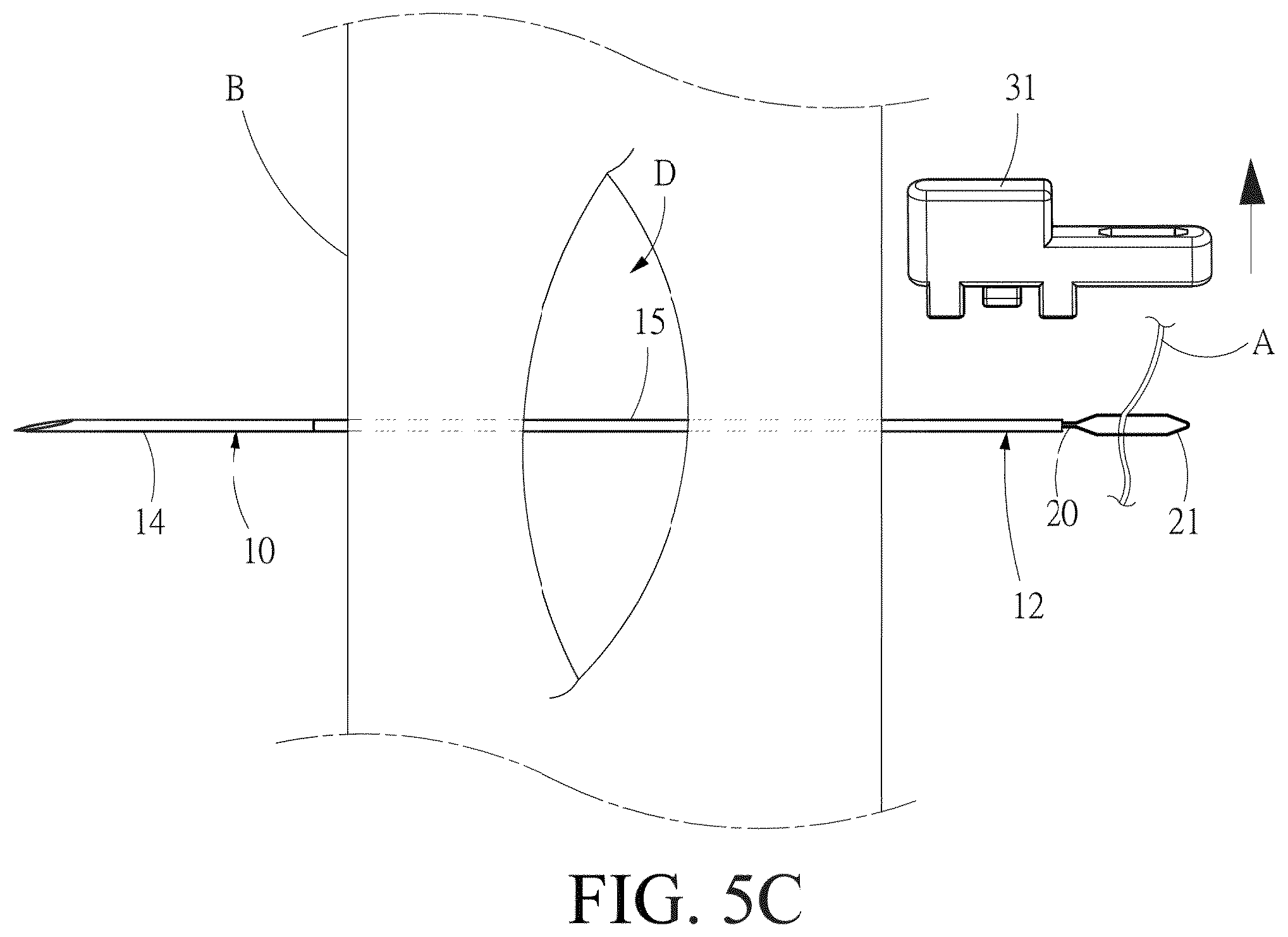 Patent US12508017 Figure 11 – Surgical guidewire device and suture fixation system