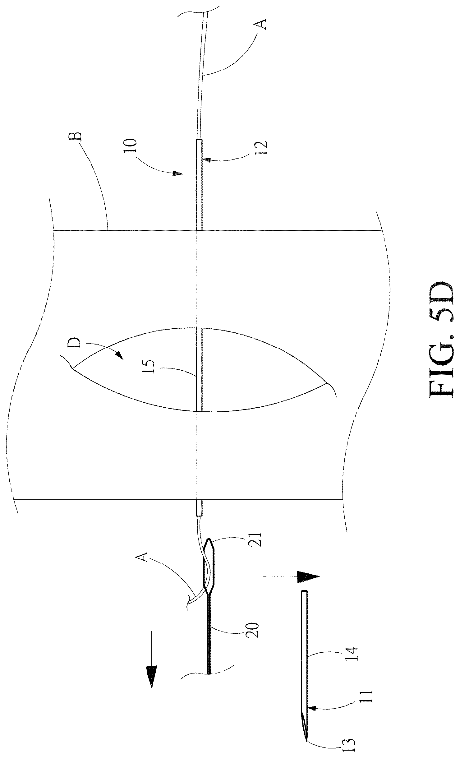 Patent US12508017 Figure 12 – Surgical guidewire device and suture fixation system