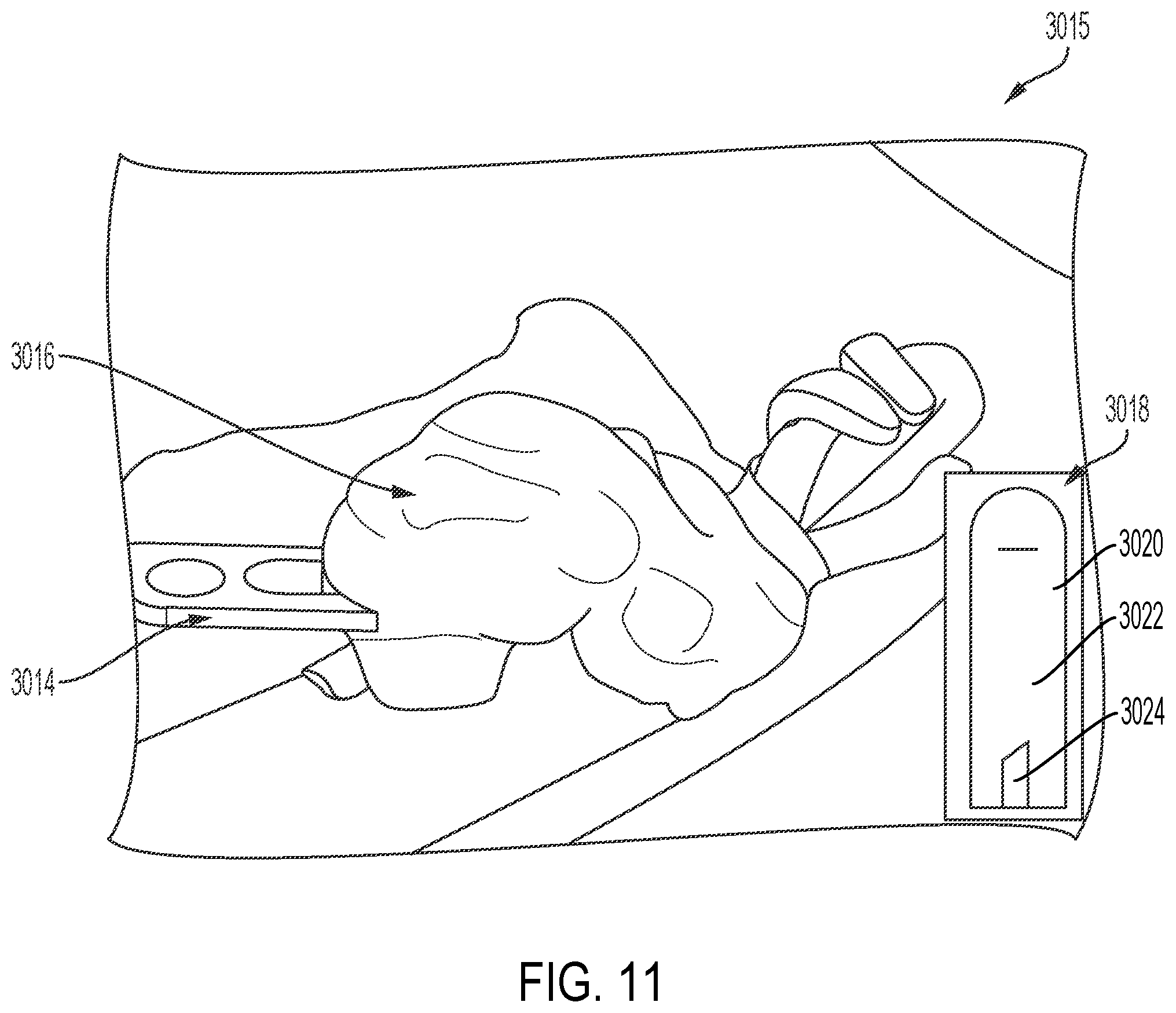 Patent US12508021 Figure 15 – Devices, systems, and methods for detecting tissue and foreign objects during a surgical operation